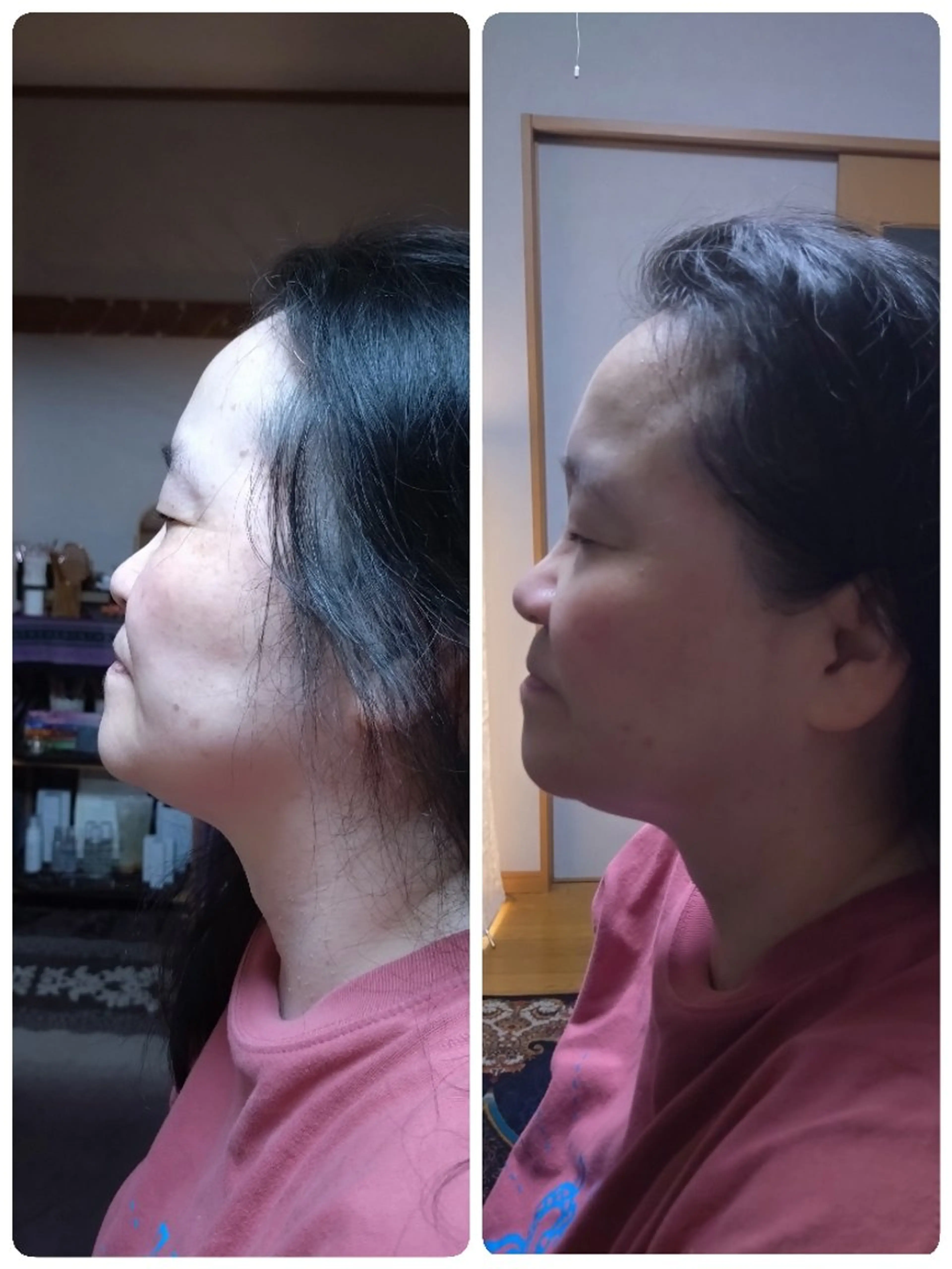 hlaada. vitaのその他イメージ