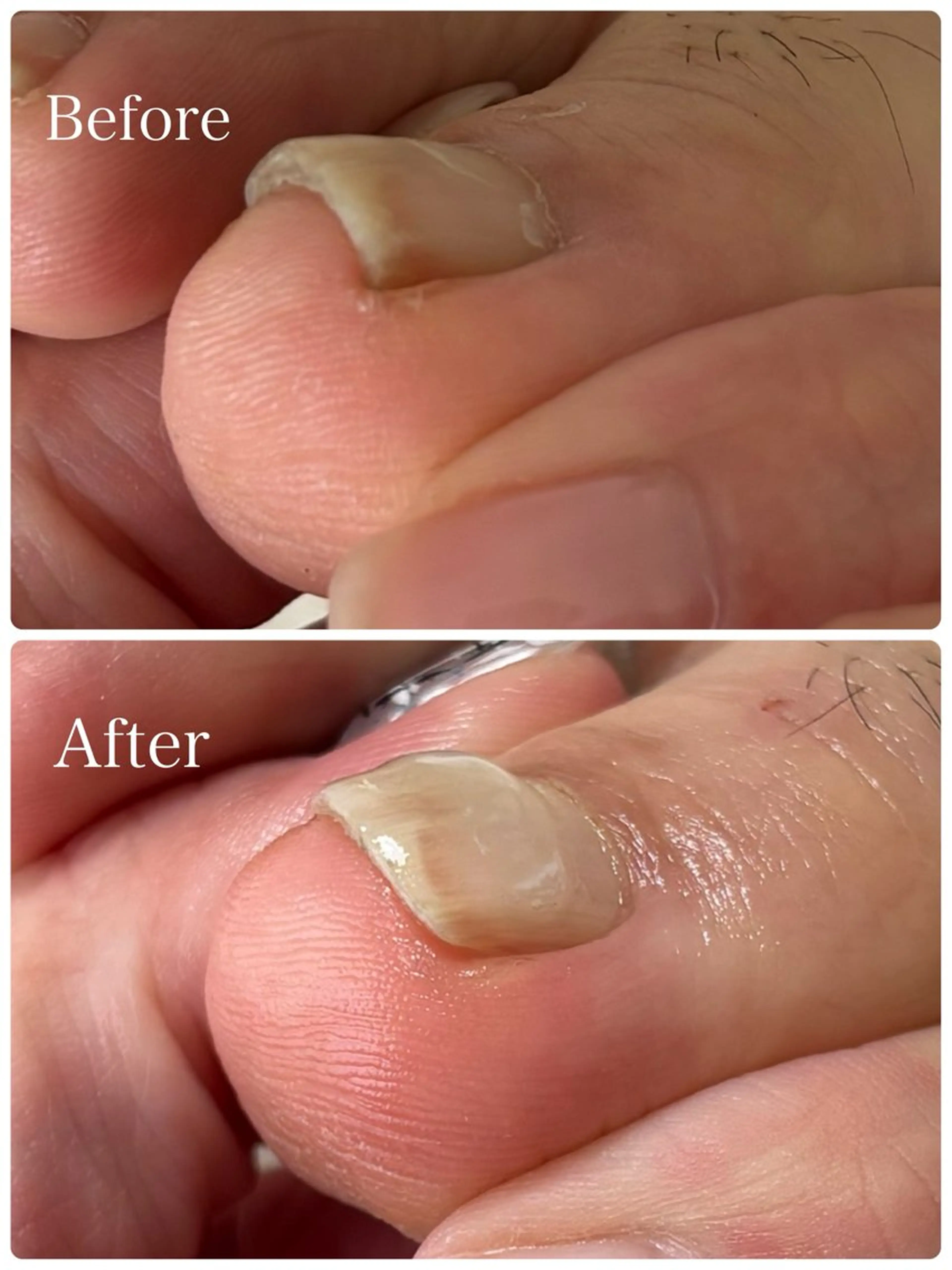 ネイル Alo.nail アロ•ネイルのネイルデザイン
