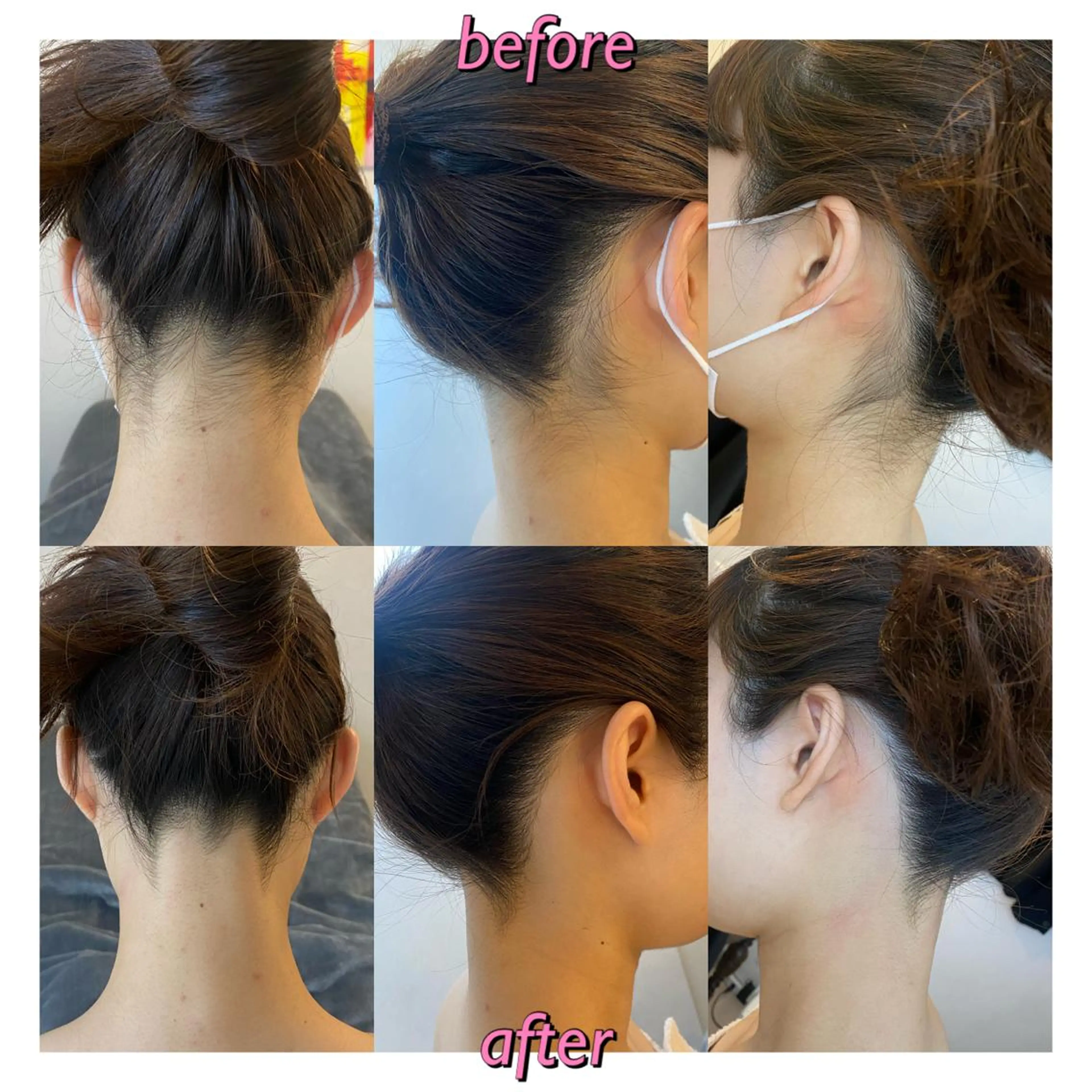 うなじ脱毛/美肌脱毛 LABELのエステ・リラクイメージ