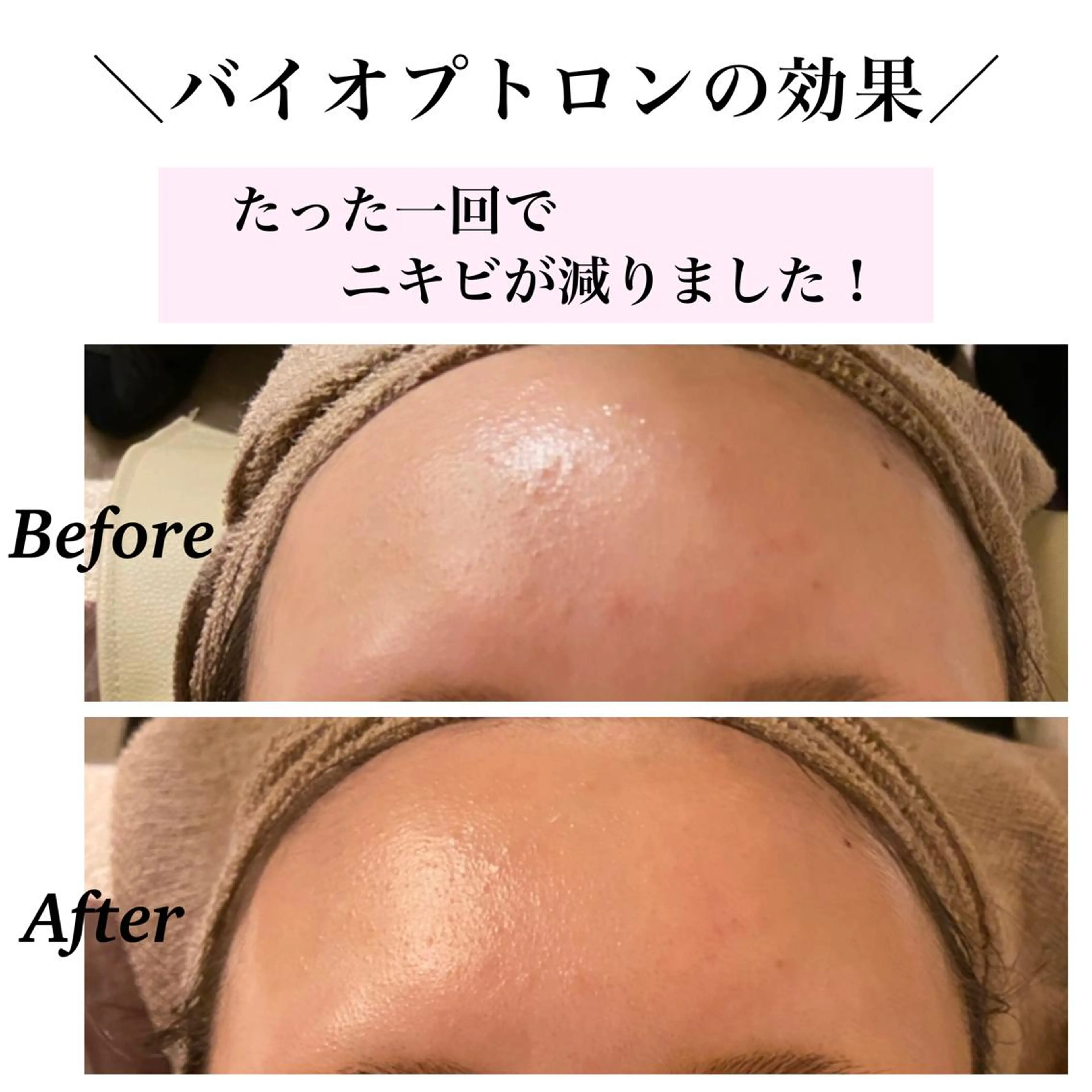 エステ リラク Bellesthe （ベルエステ）のエステ・リラクイメージ