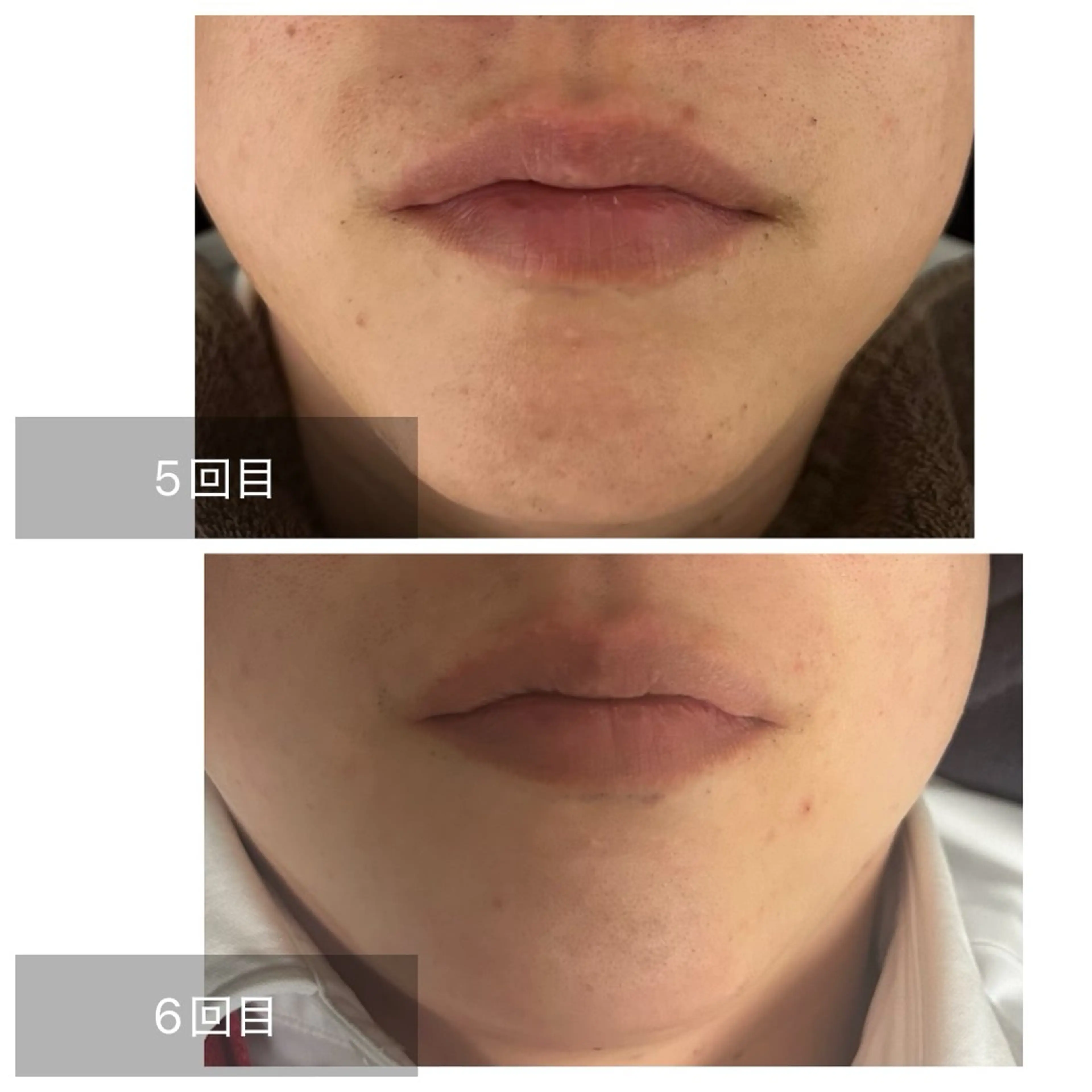 メンズ 脱毛 エマニエル USAのエステ・リラクイメージ