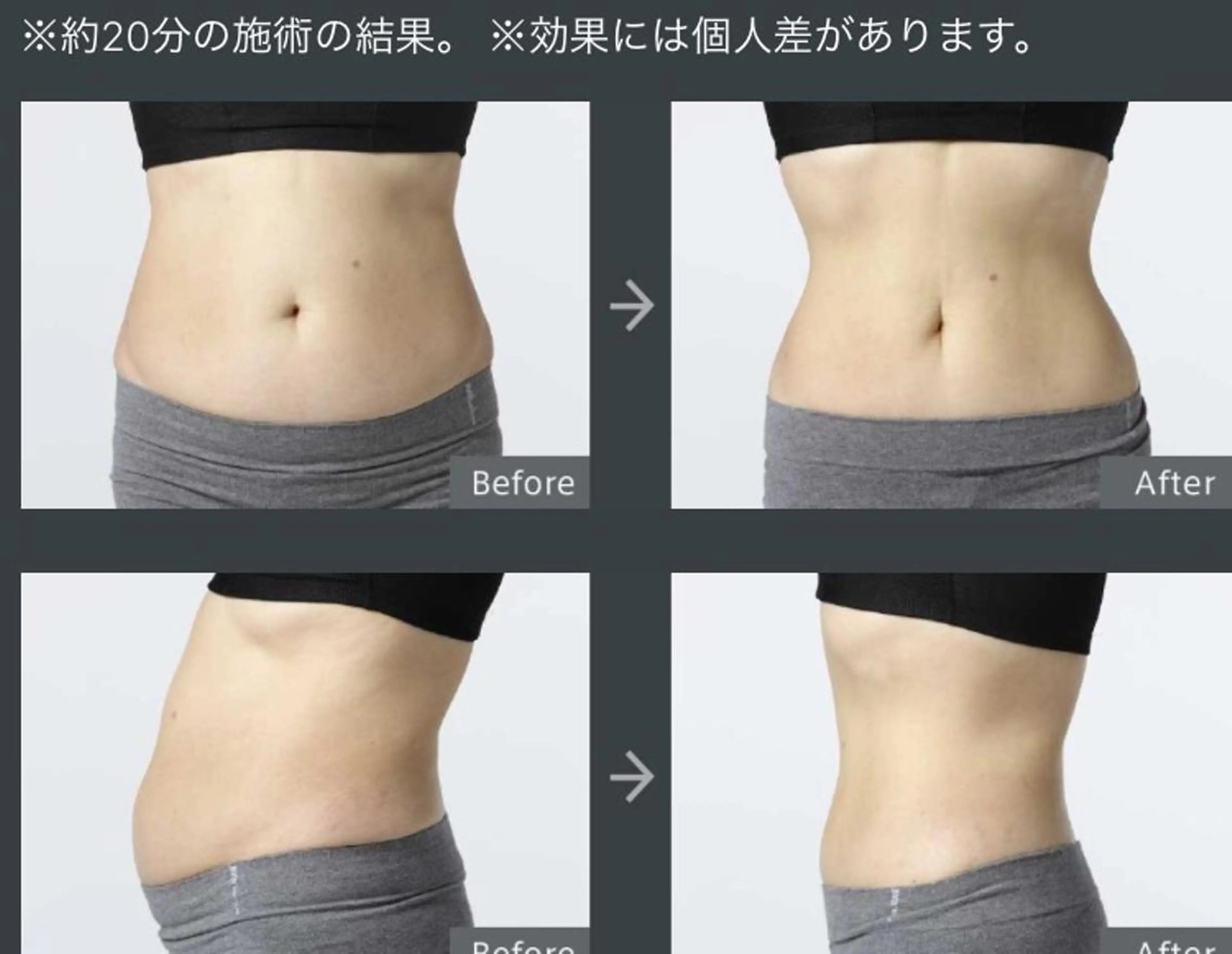 🌹女性ホルモン改善＆冬太り予防集中痩身🌹【お腹卵巣保養ケア➕上半身orお腹卵巣保養ケア➕下半身】90分→11000円の写真