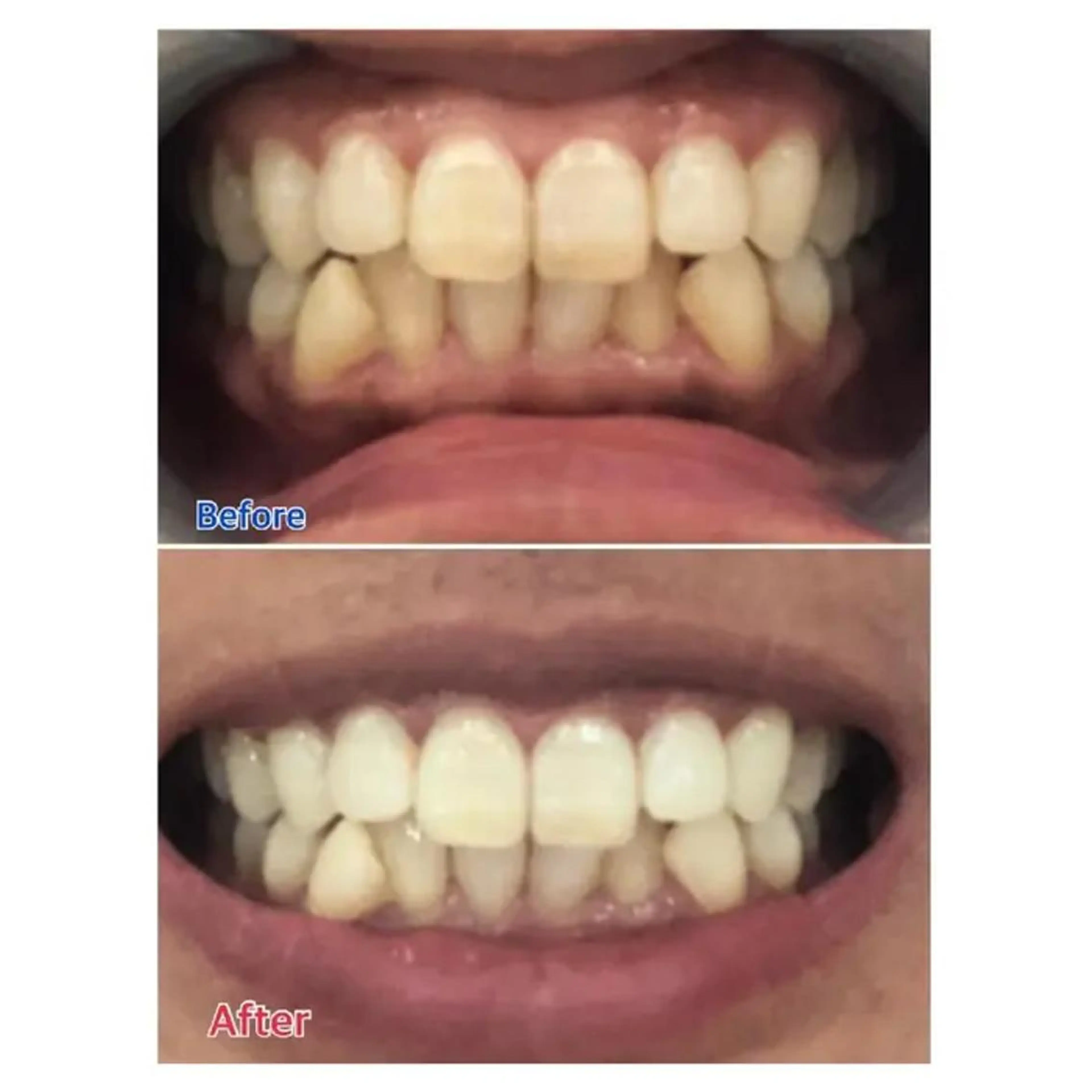 M渋谷 ホワイトニングのエステ・リラクイメージ