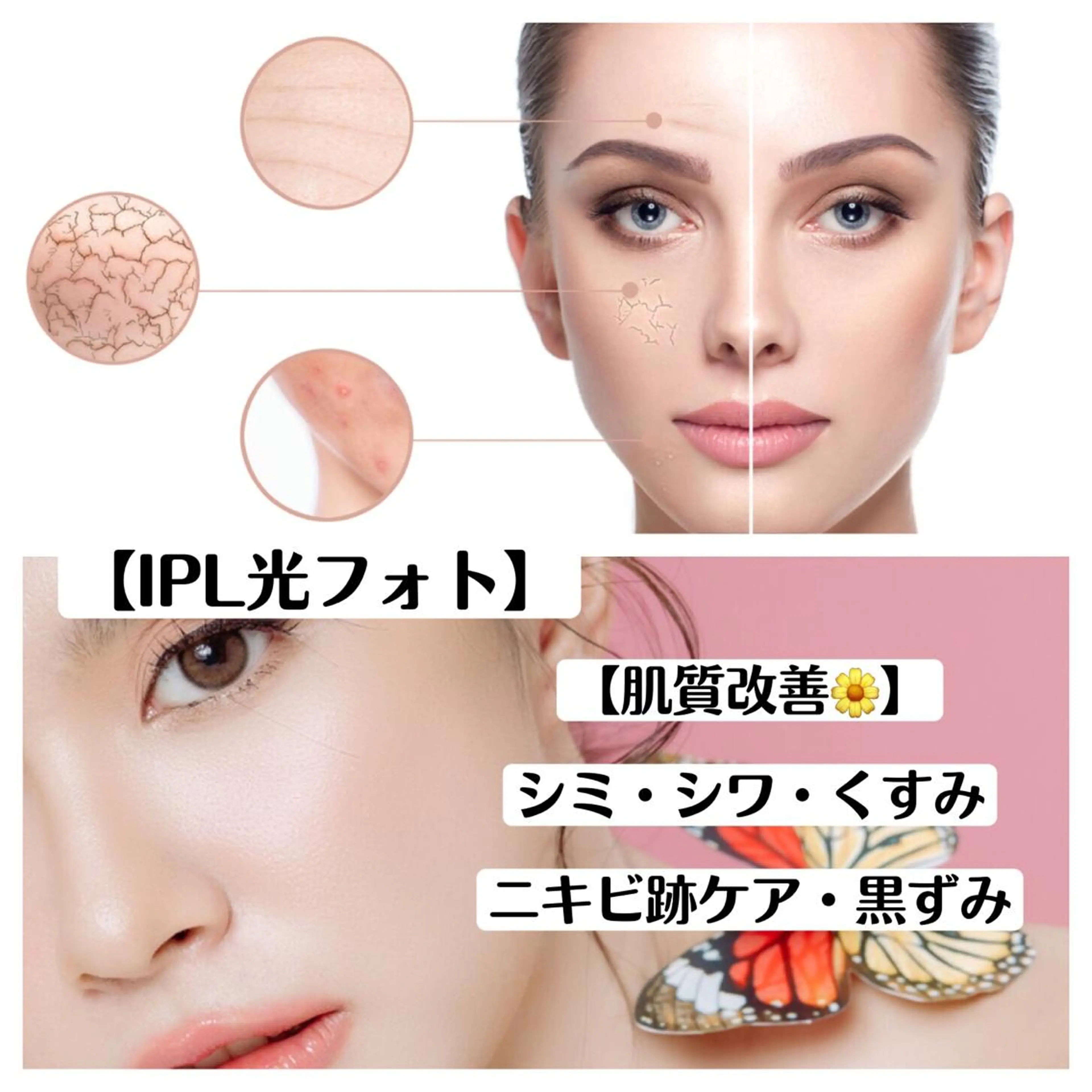 ショート カラー パーマ ヘアアレンジ メンズ キッズ ネイル マツエク・マツパ アイブロウ 学生（メンズ向け） 透明感カラー 眉毛ワックス脱毛 学生 小顔カット Chloe-クロエ- 脱毛/フェイシャルのエステ・リラクイメージ