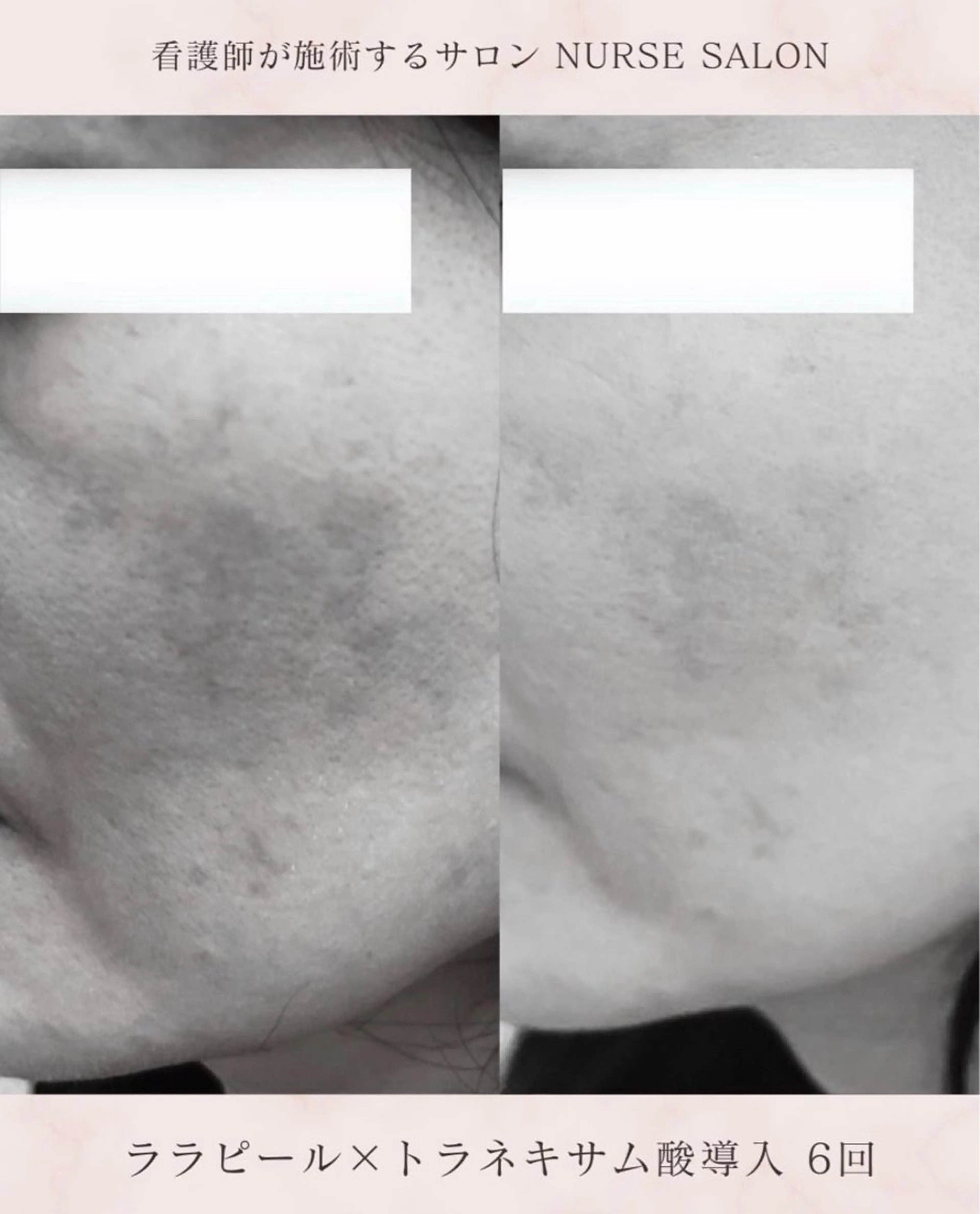 エステ 🌟看護師が施術🪄 ナスサロ/狩野のエステ・リラクイメージ