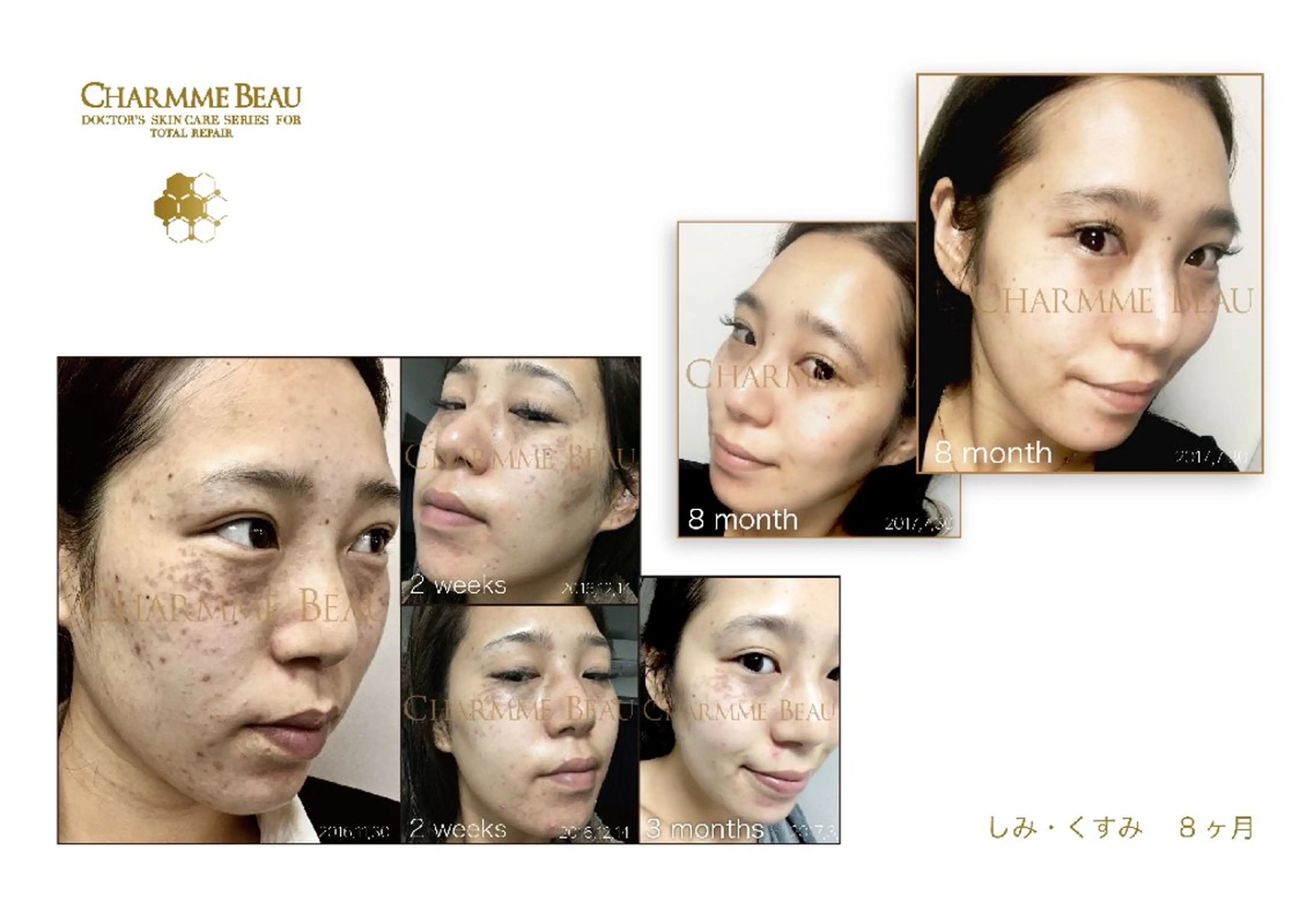 肌質改善サロン renew/ｳｴｷのエステ・リラクイメージ