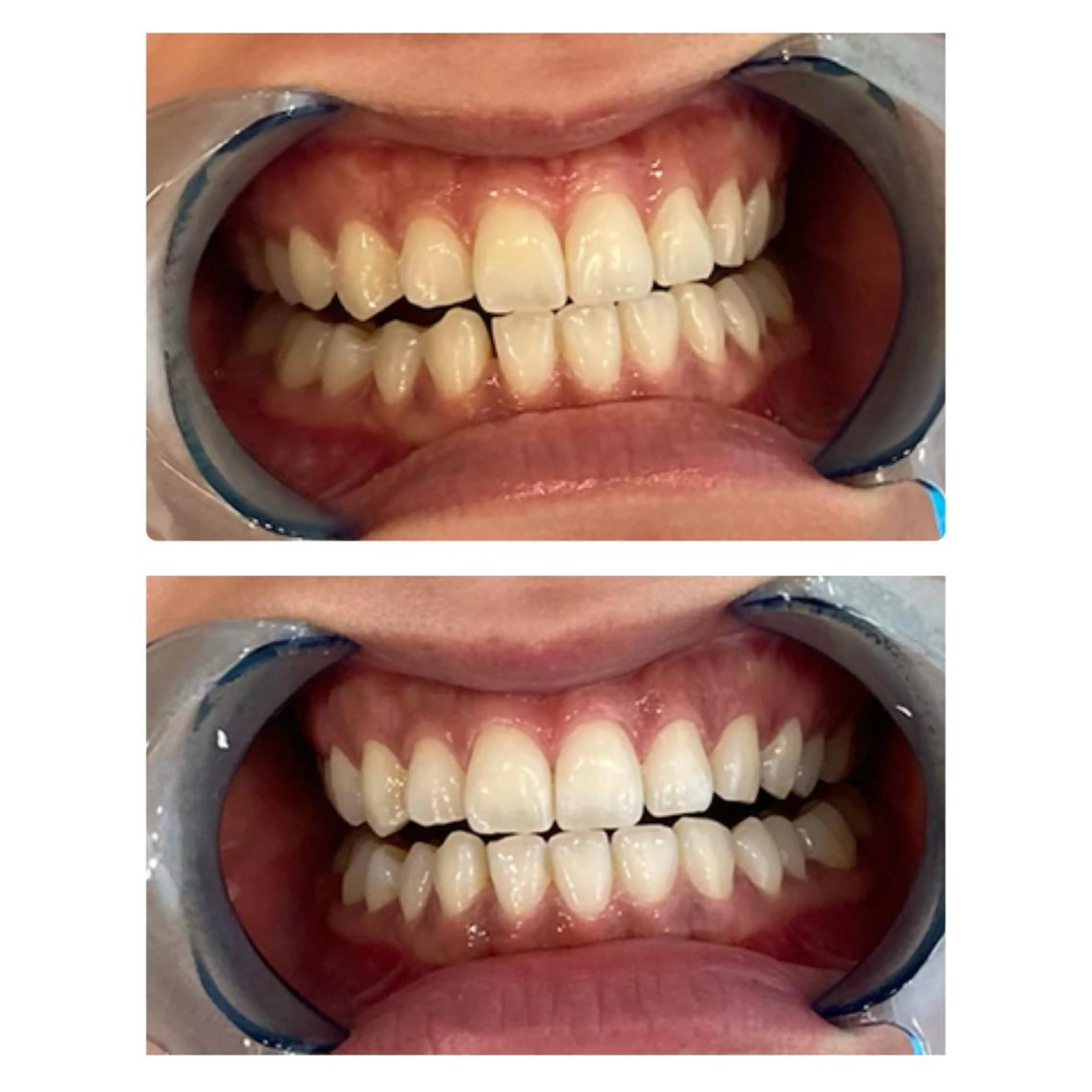 【歯科提携】柏ホワイ トニングスタイルのその他イメージ