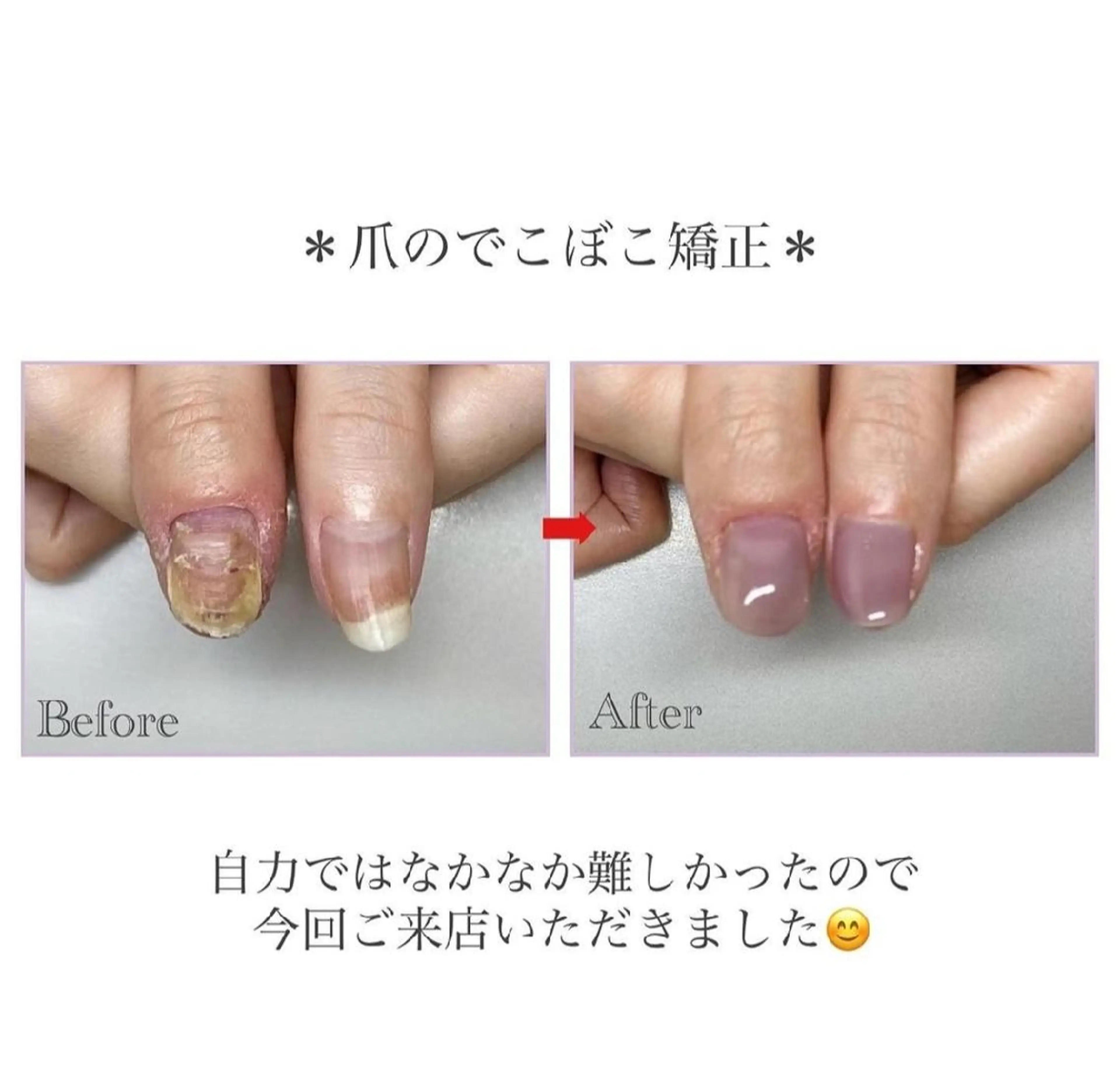 ネイル ネイルサロン アリュームのネイルデザイン