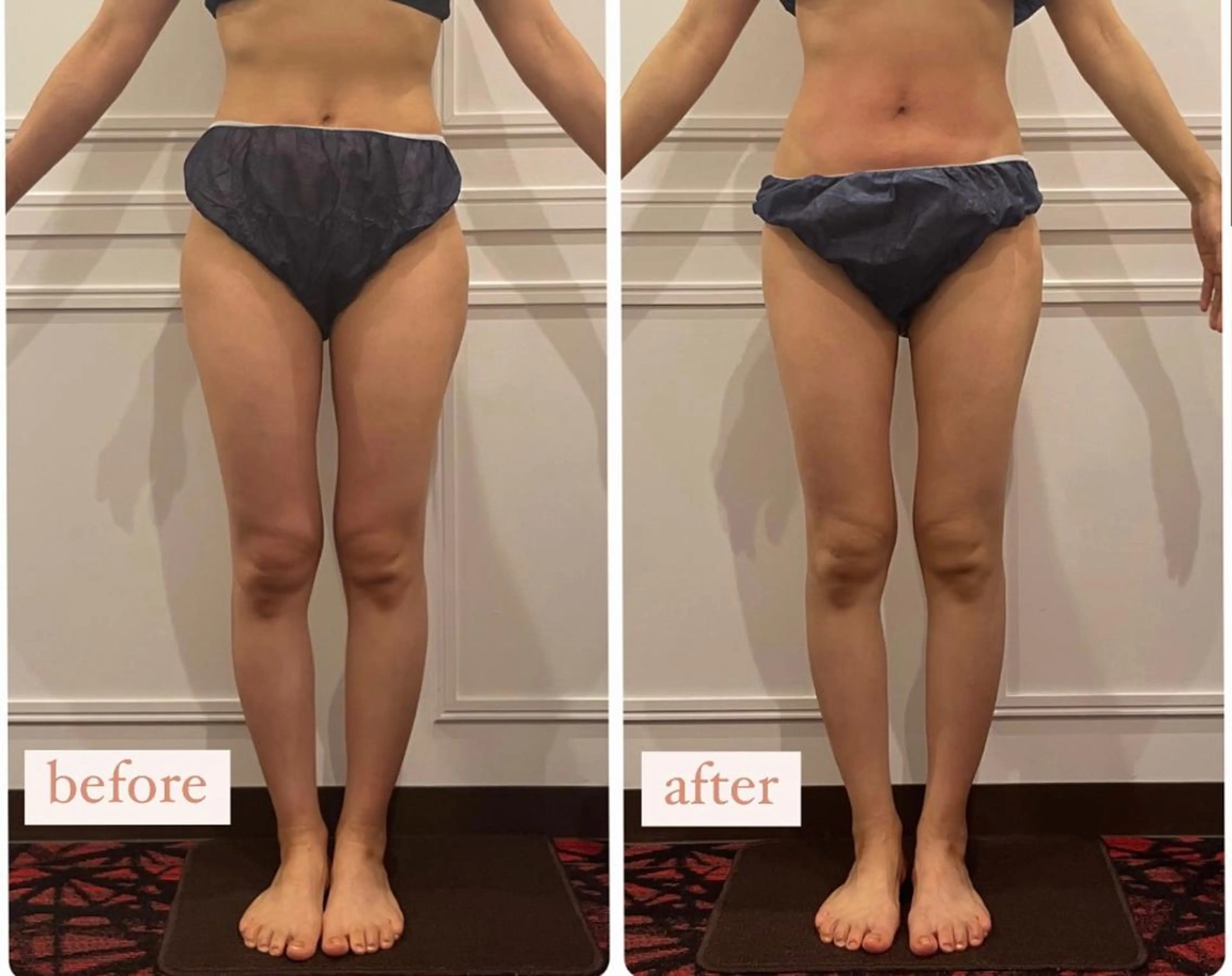 立体小顔×艶肌×美ボ ディ似合わせ施術 岡のエステ・リラクイメージ