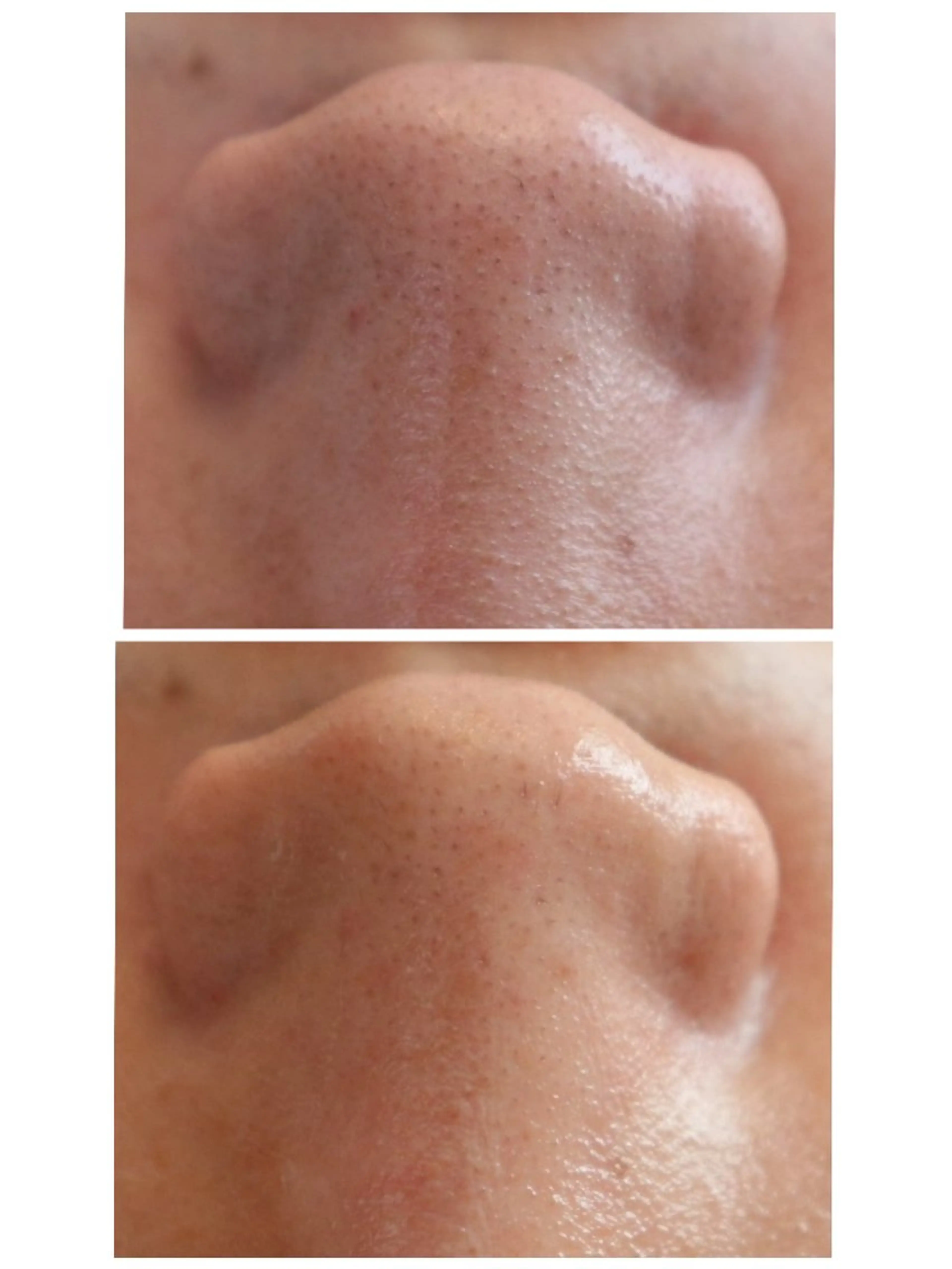 エステサロン NICOLIのエステ・リラクイメージ