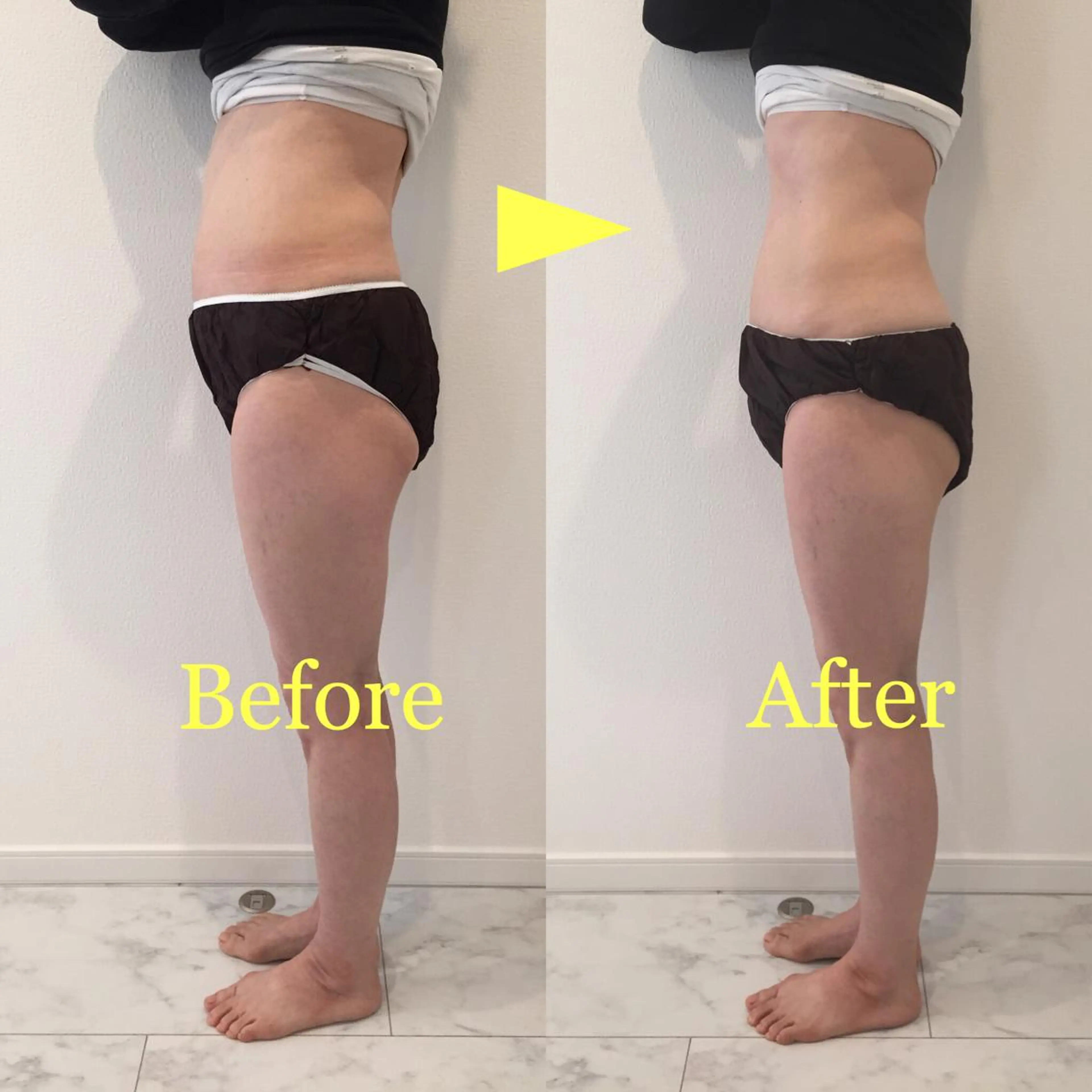 お腹痩せコースの写真