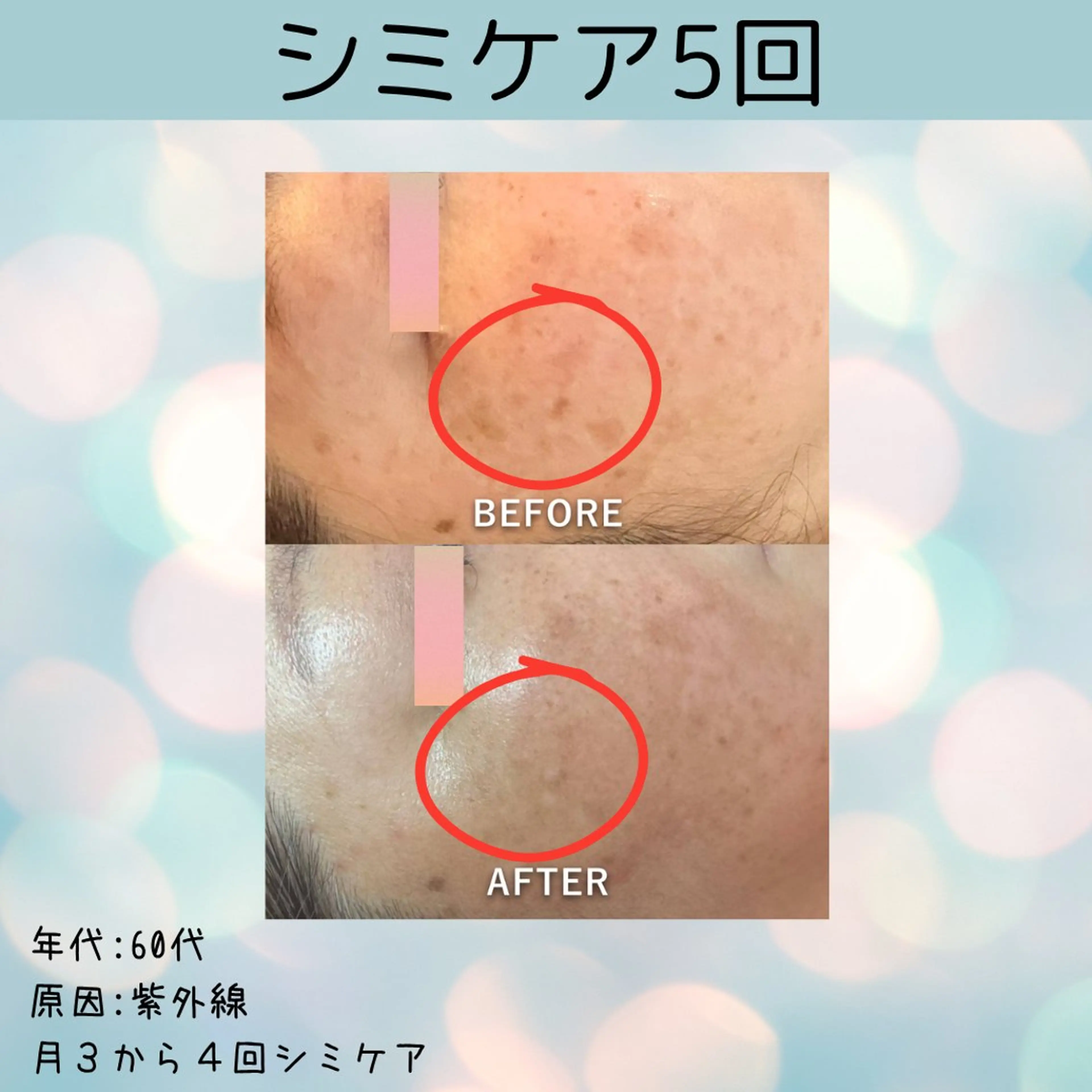 エステ 🌞シミケアサロン @SUNiko🌴のエステ・リラクイメージ