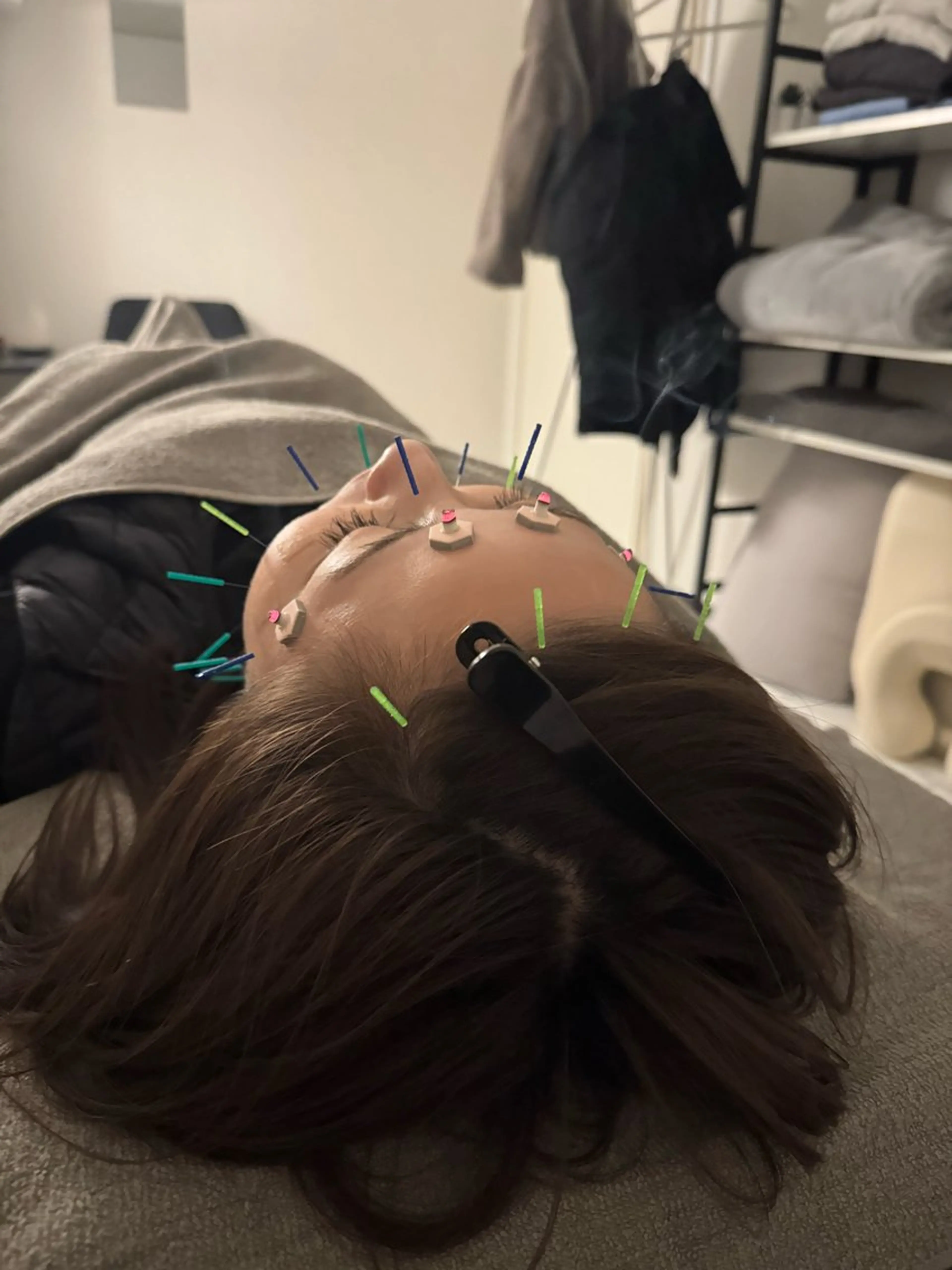 エステ 美容鍼×小顔矯正 ×美容整体 浜川泰仁のエステ・リラクイメージ