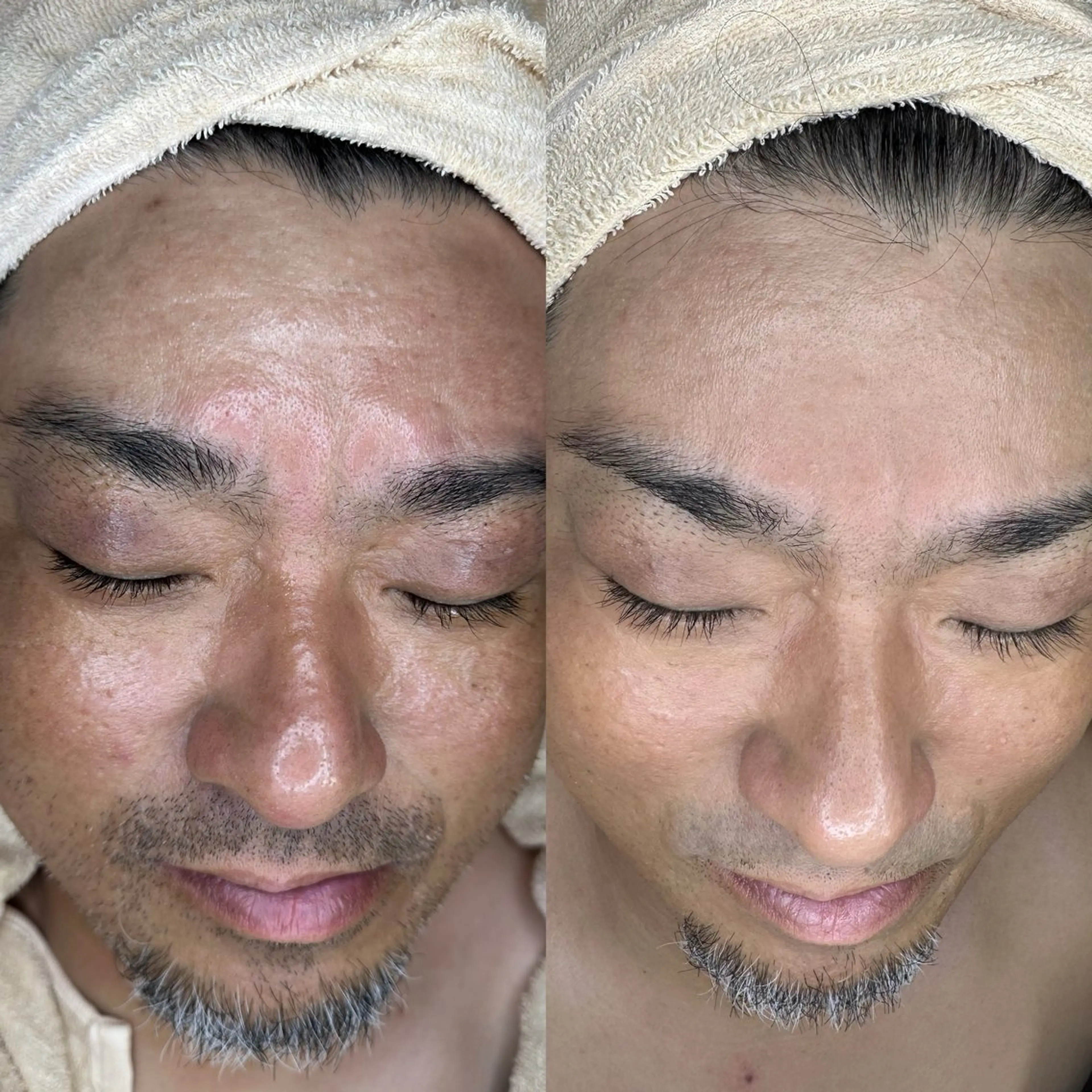 その他 シミケア専門サロン 10POINT.Kのエステ・リラクイメージ