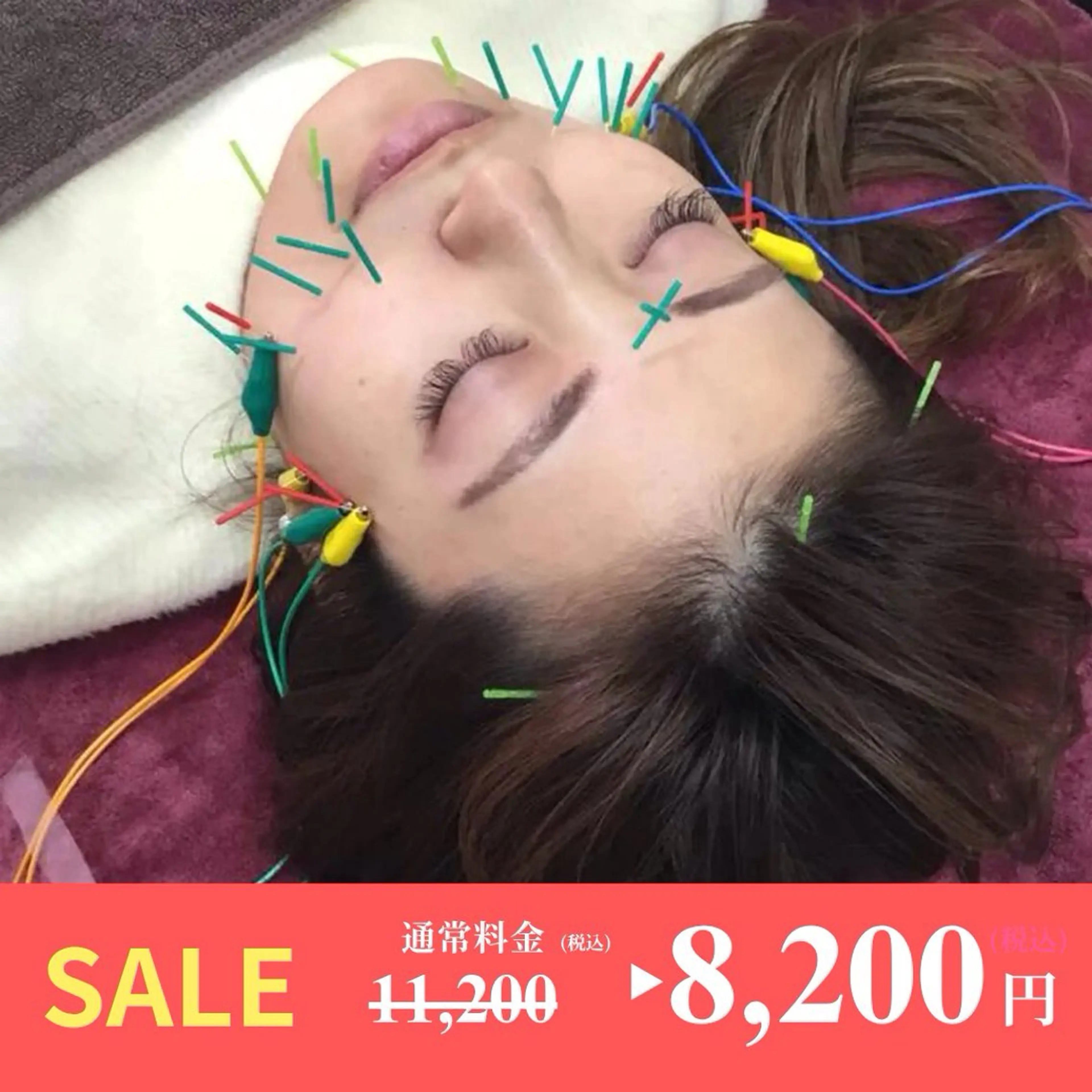 【電気美容鍼】【1番人気】【初回割引キャンペーン中】💖楊貴妃コース❗️の写真