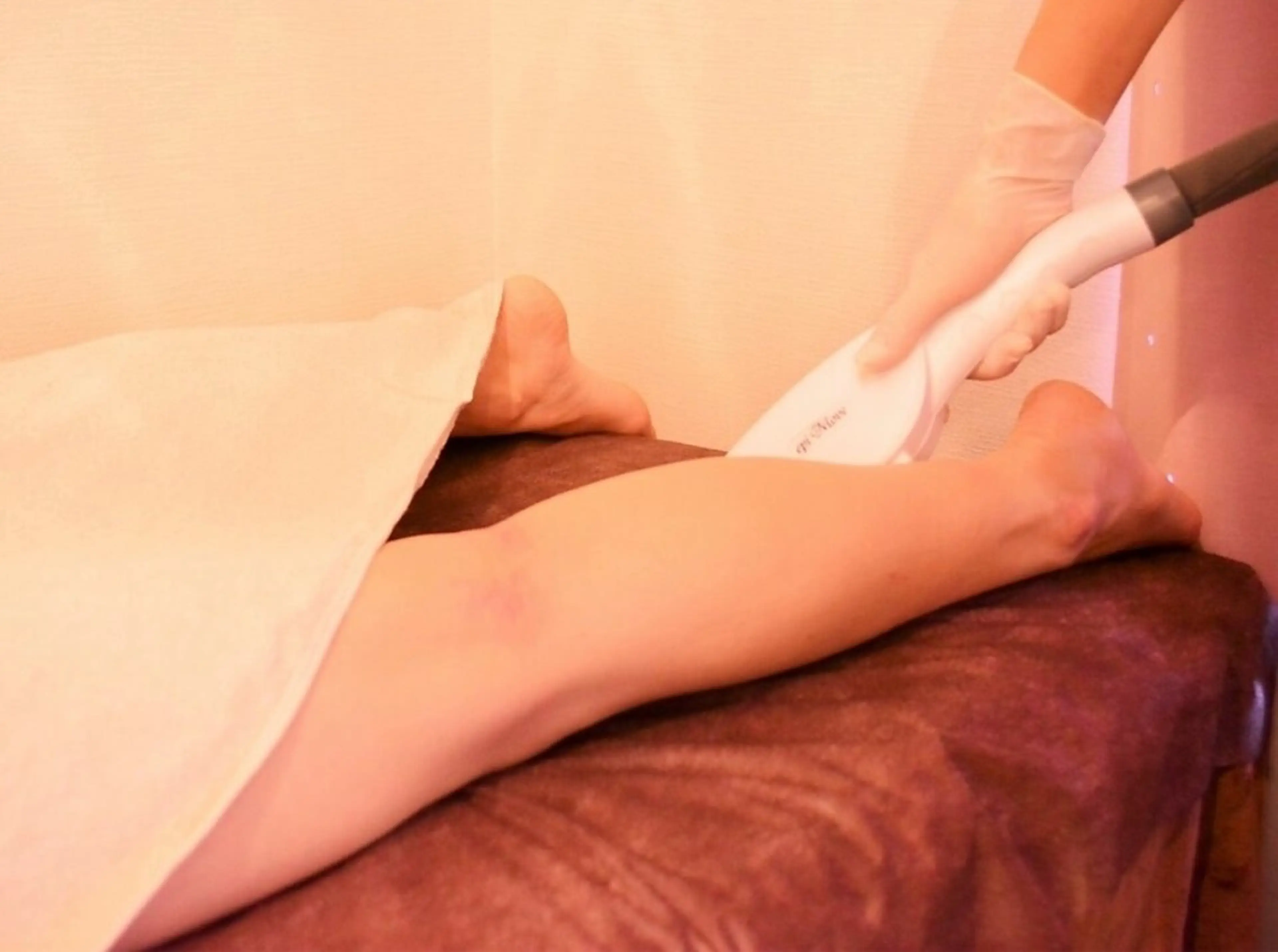 【新規】5パーツチョイス脱毛（美肌マシン脱毛）【女性限定】の写真