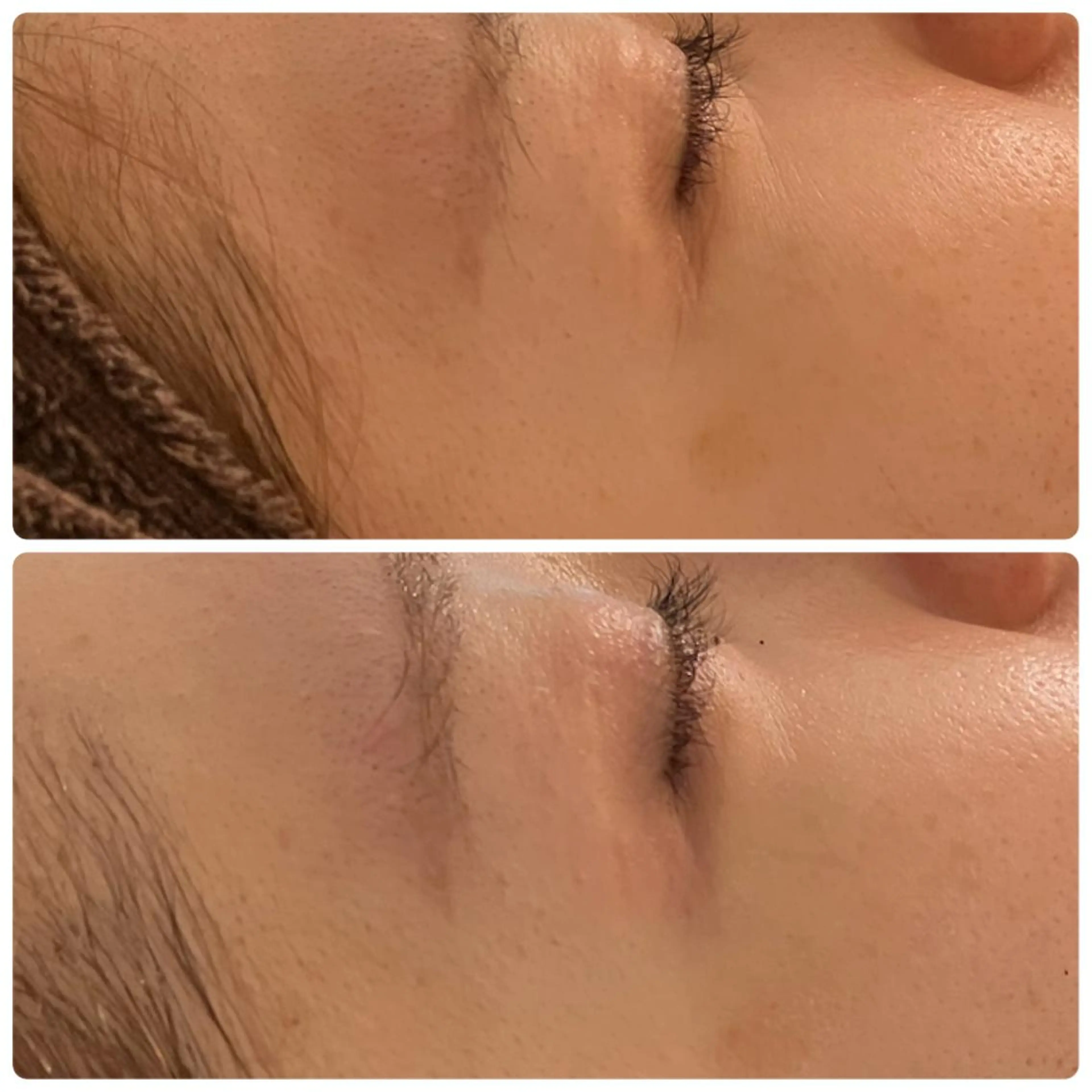 エステ luana beauty所属・kana ハーブピーリング🌿のエステ・リラクイメージ