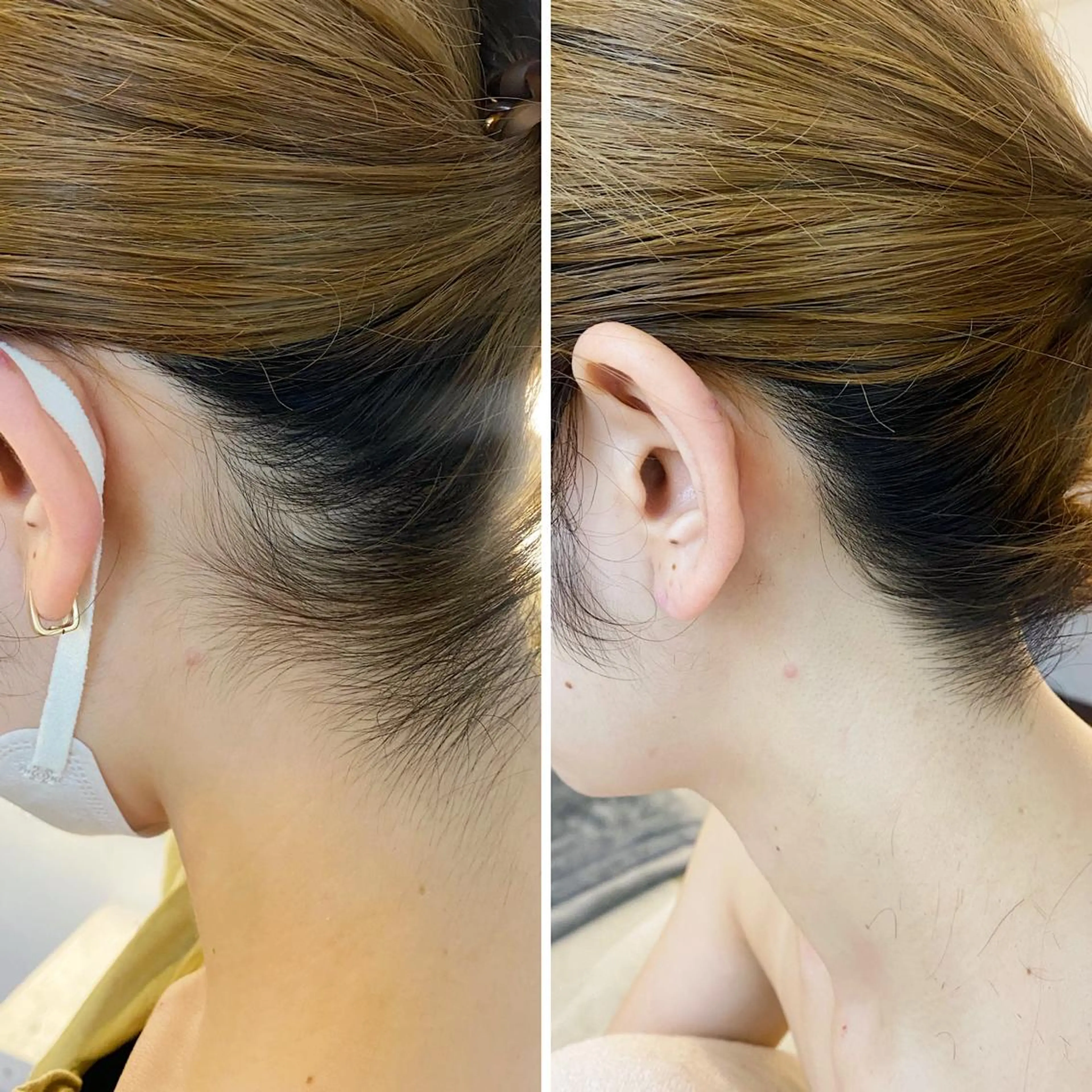 脱毛 うなじ脱毛/美肌脱毛 LABELのエステ・リラクイメージ