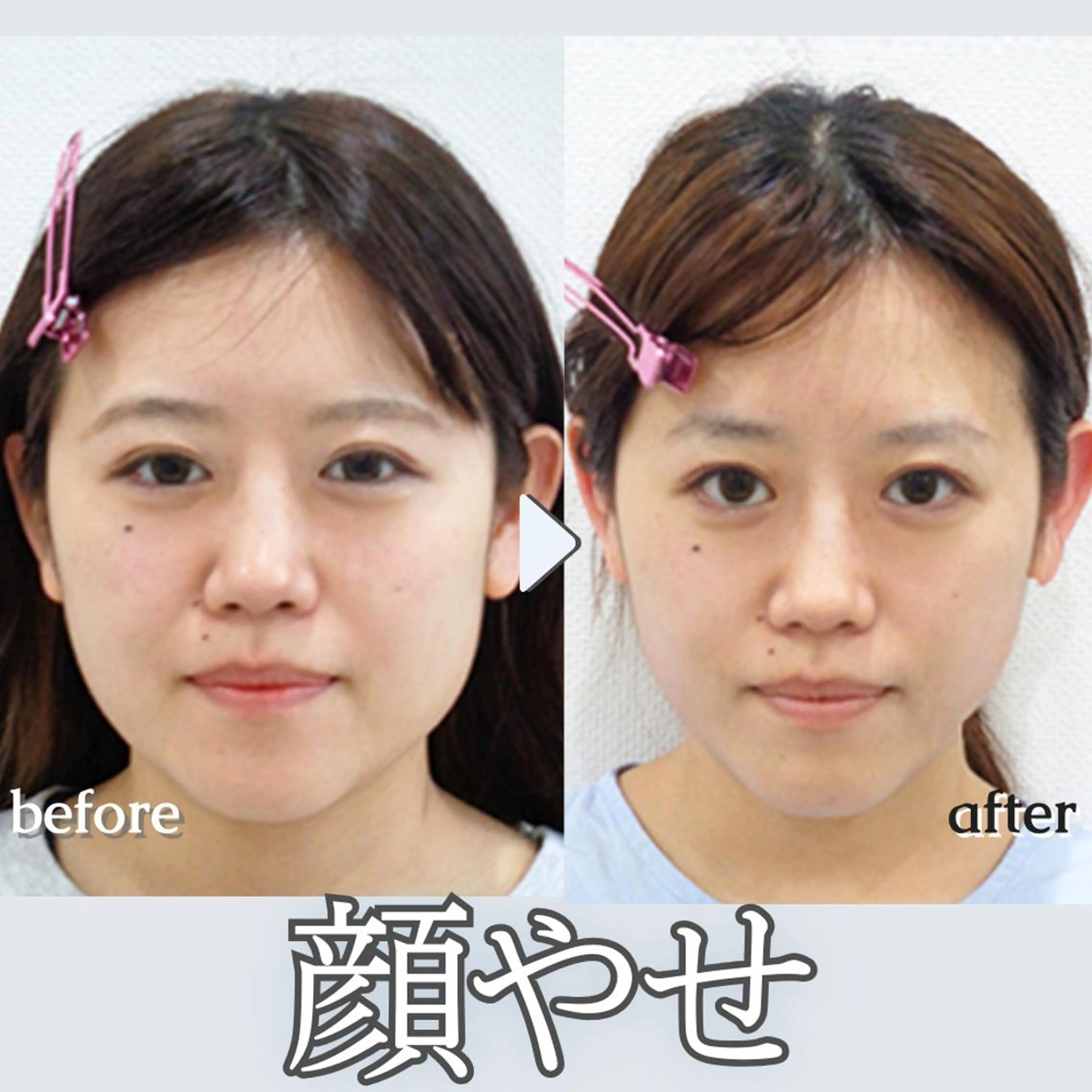 美.design 表参道店のエステ・リラクイメージ