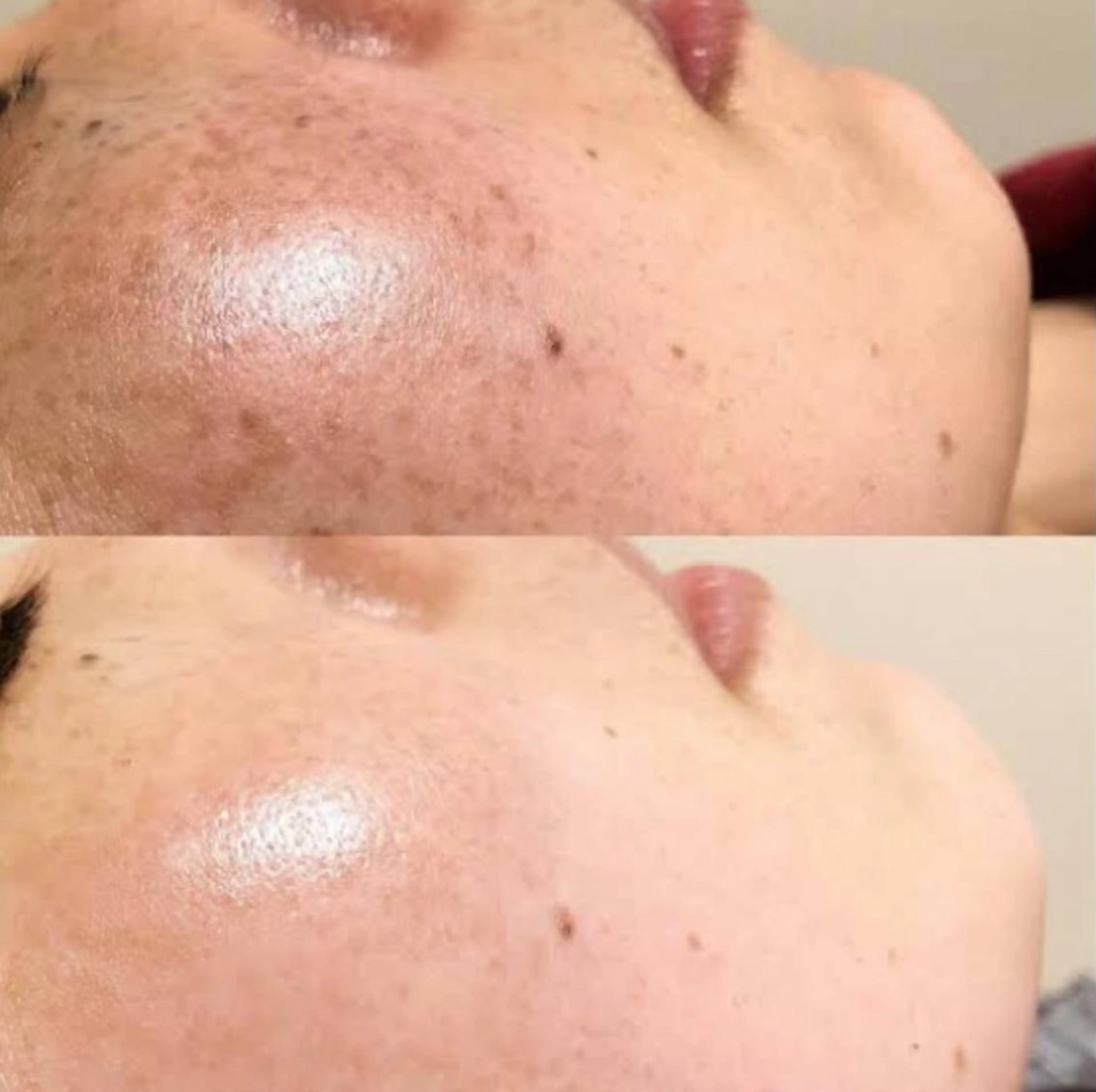 エステ Charme Esbeaute所属・南森町 ｃｅのマツエク・マツパデザイン