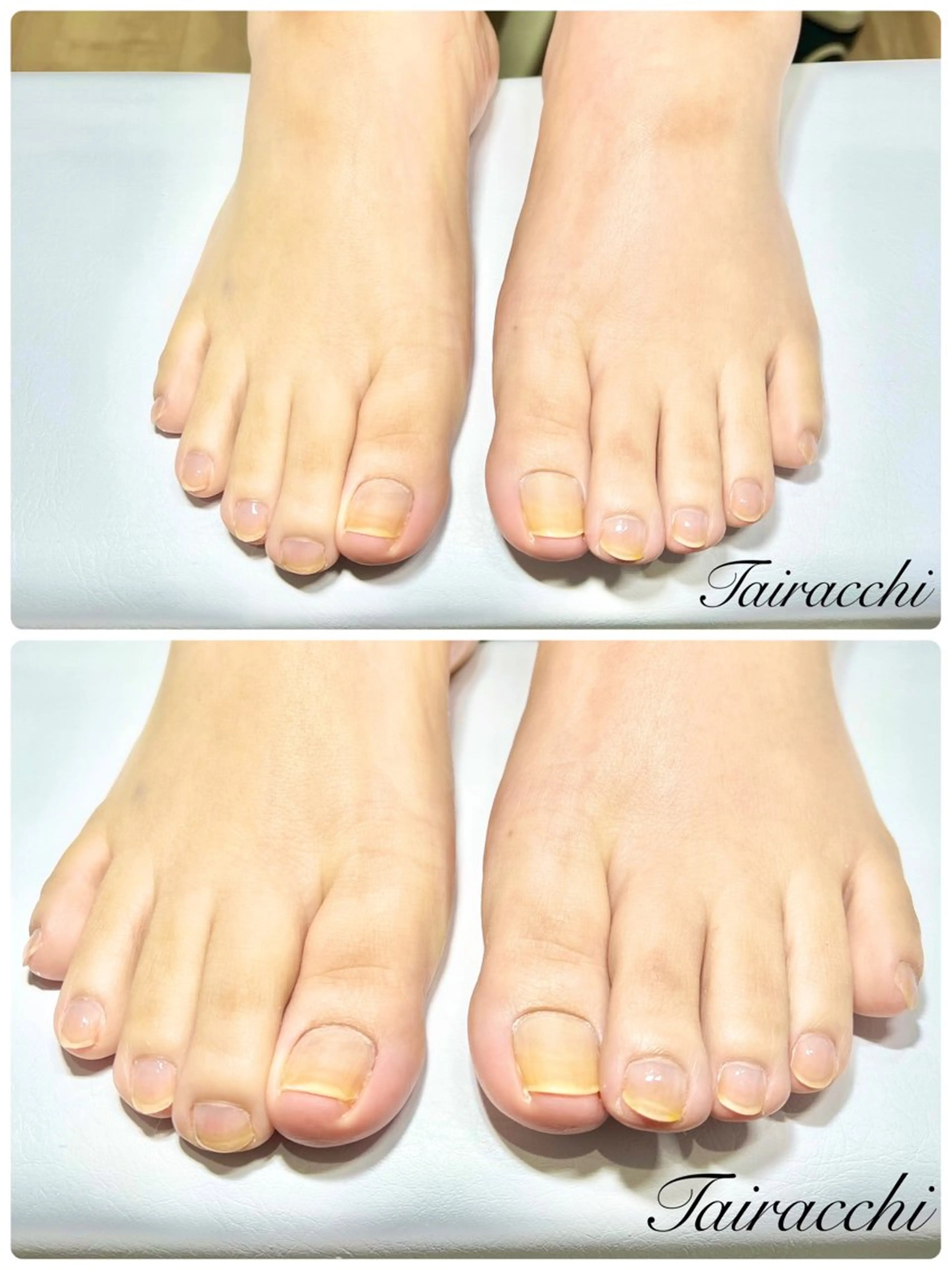 ネイル フットネイル フットネイル Tairacchi タイラッチのエステ・リラクイメージ