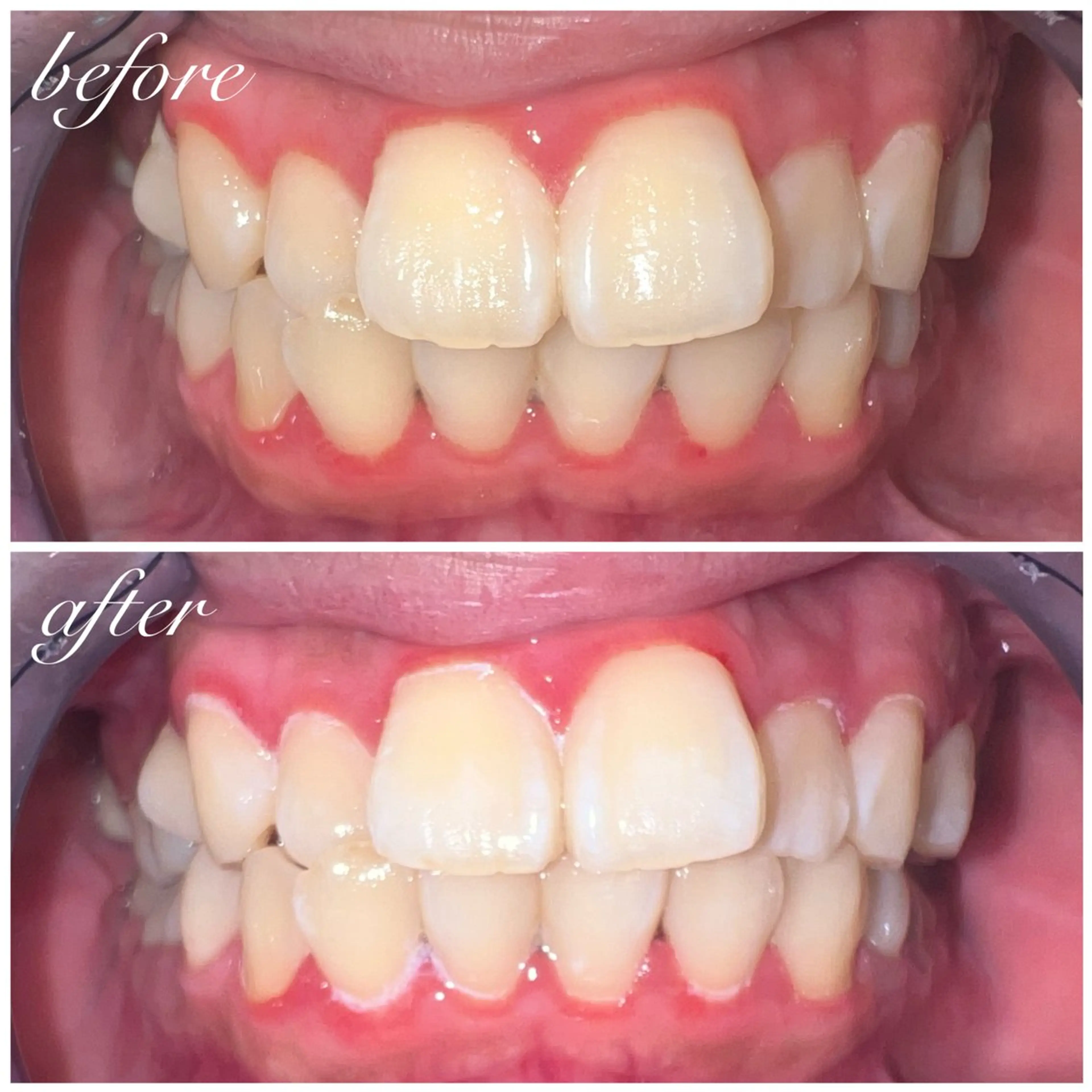 Luze 泉 明日花のネイルデザイン