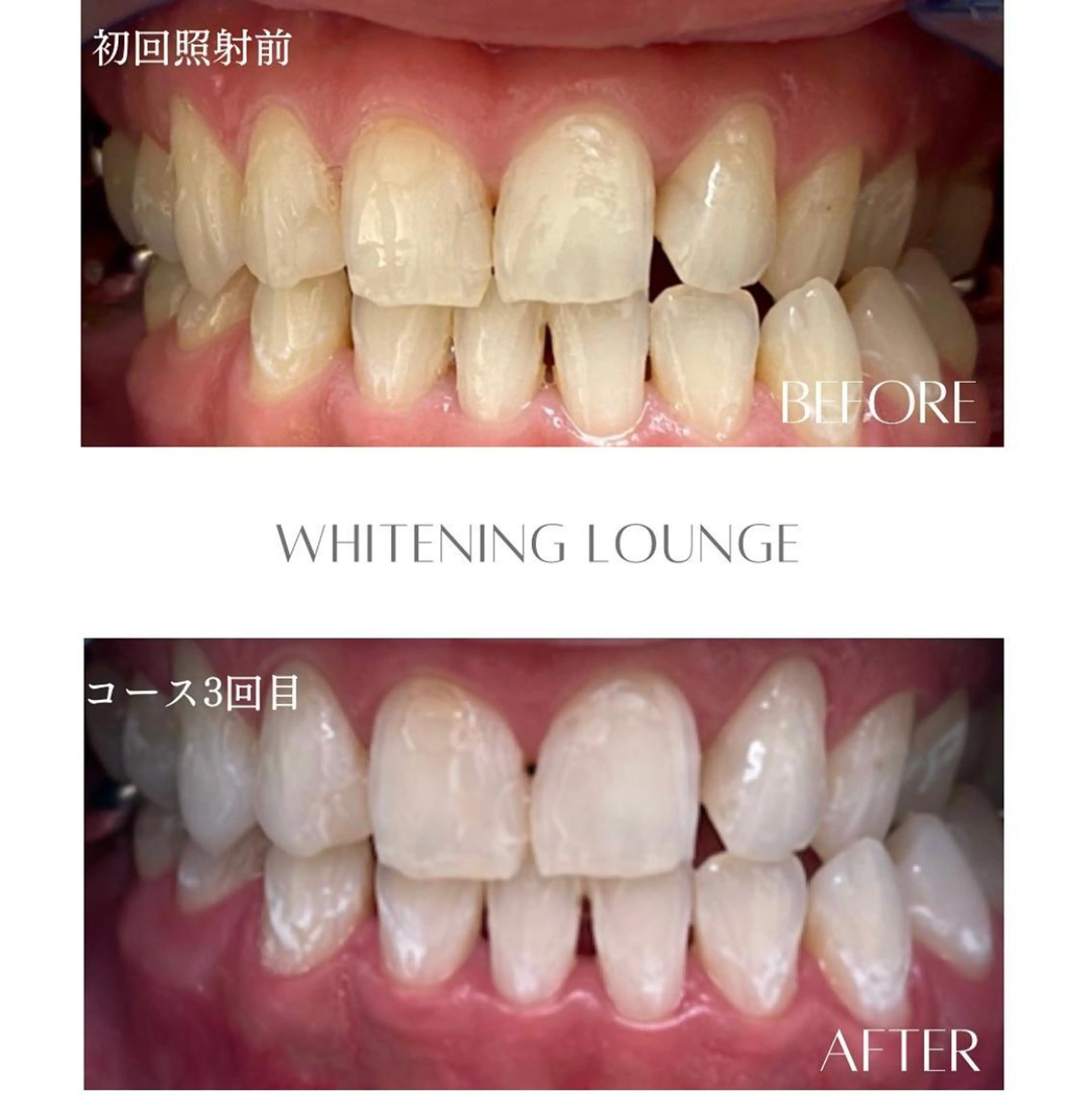 ホワイトニングラウンジ横須賀所属・ホワイトニング Lounge横須賀のエステ・リラクイメージ