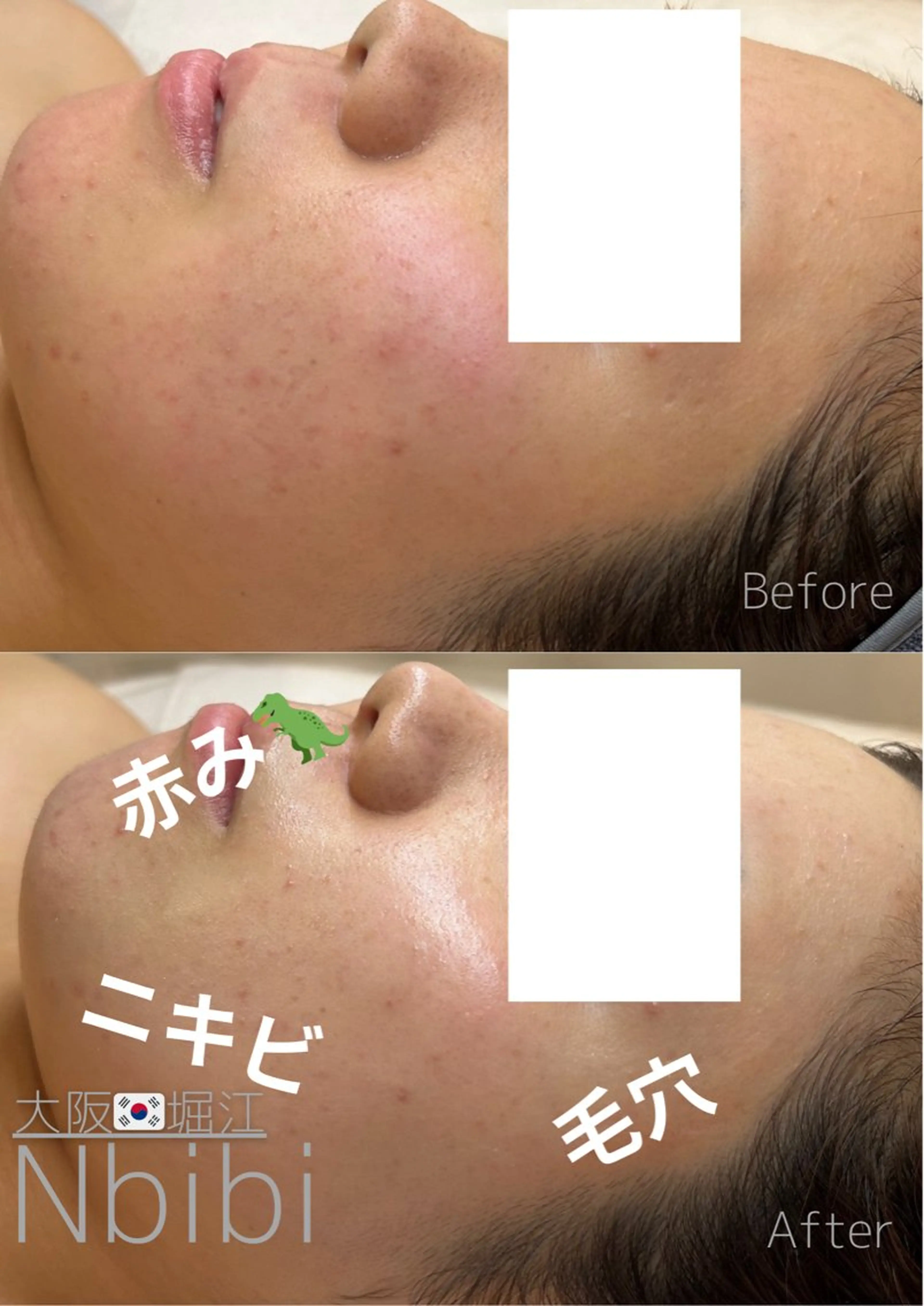 エステ 韓国🇰🇷価格 サロン_Nbibiの眉毛・アイブロウイメージ