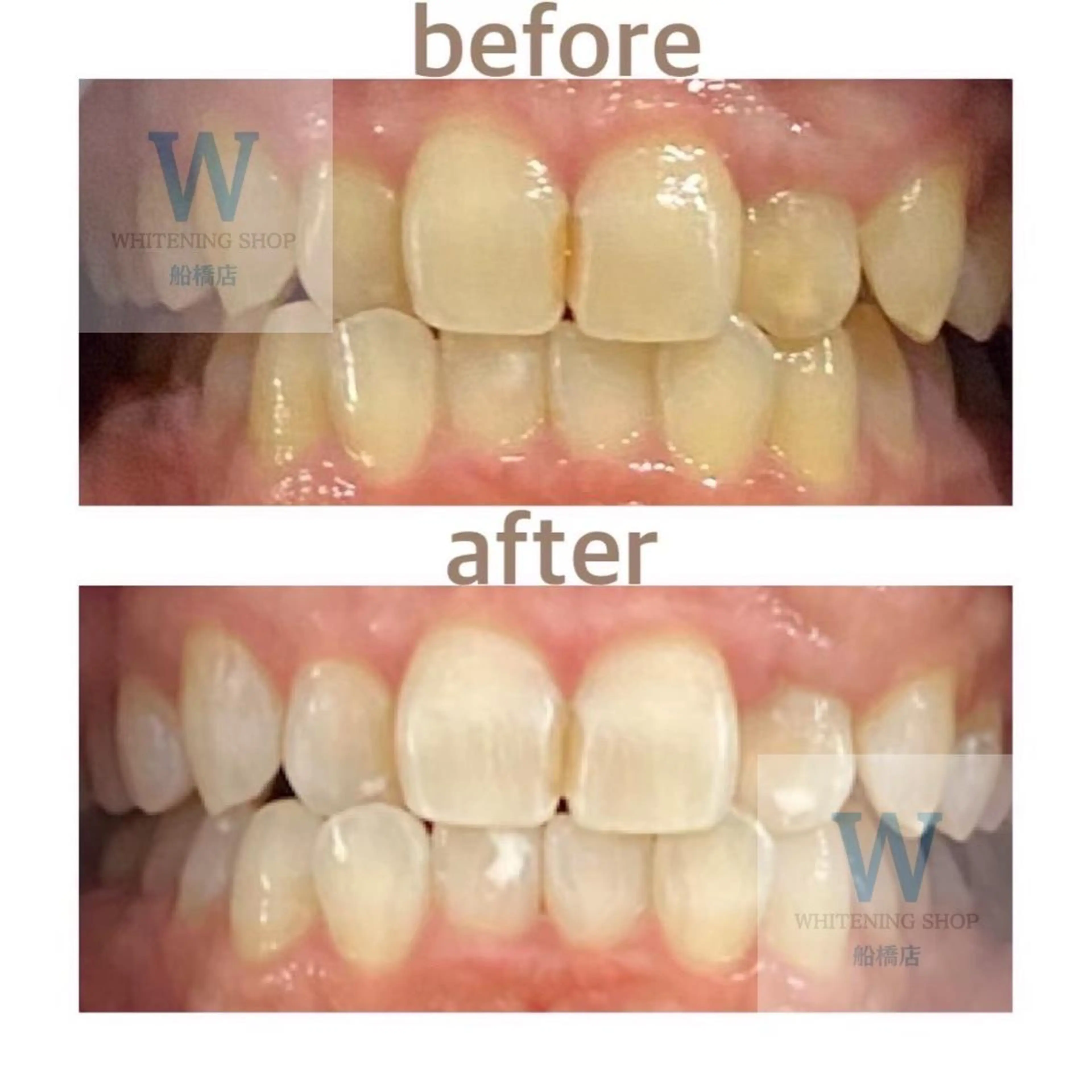 エステ リラク ホワイトニング ショップ船橋２号店のエステ・リラクイメージ