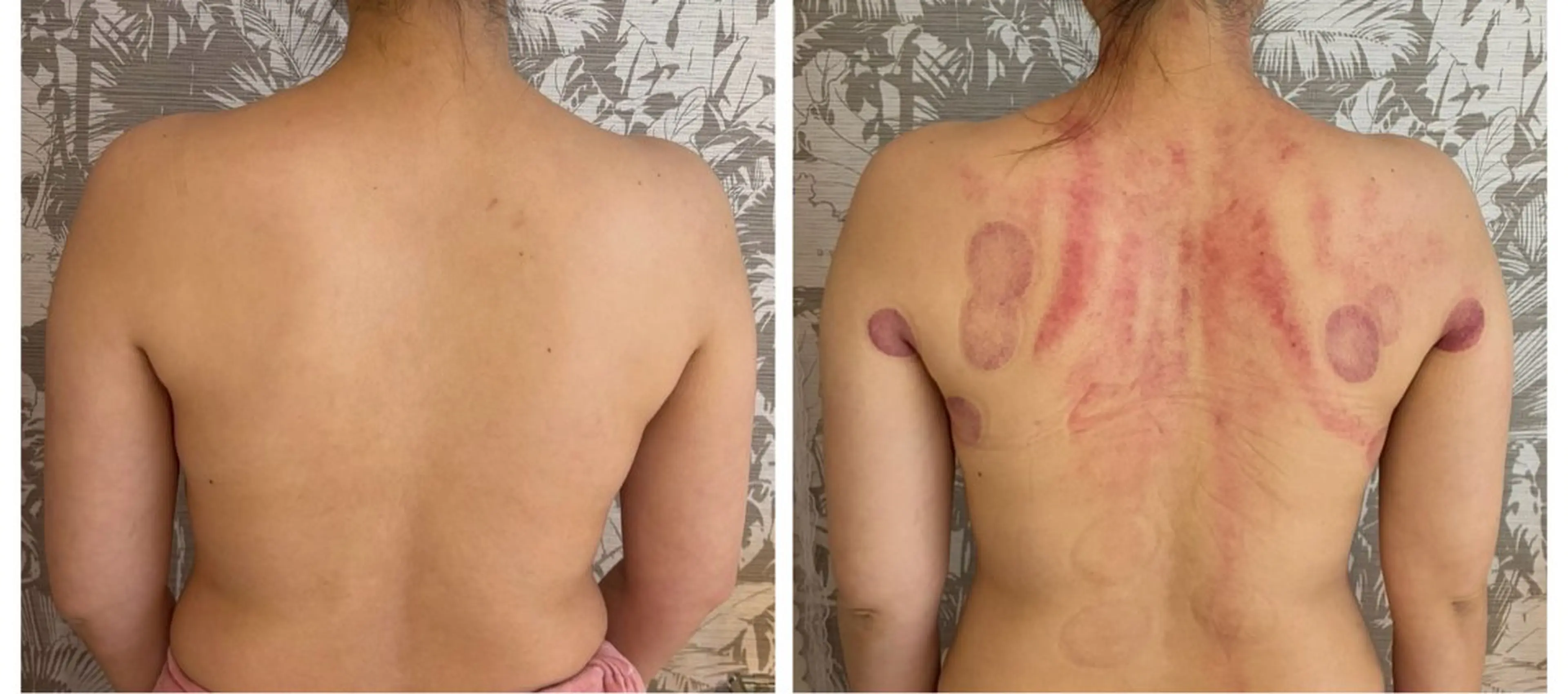 リラク moonlit. 田上りかのエステ・リラクイメージ