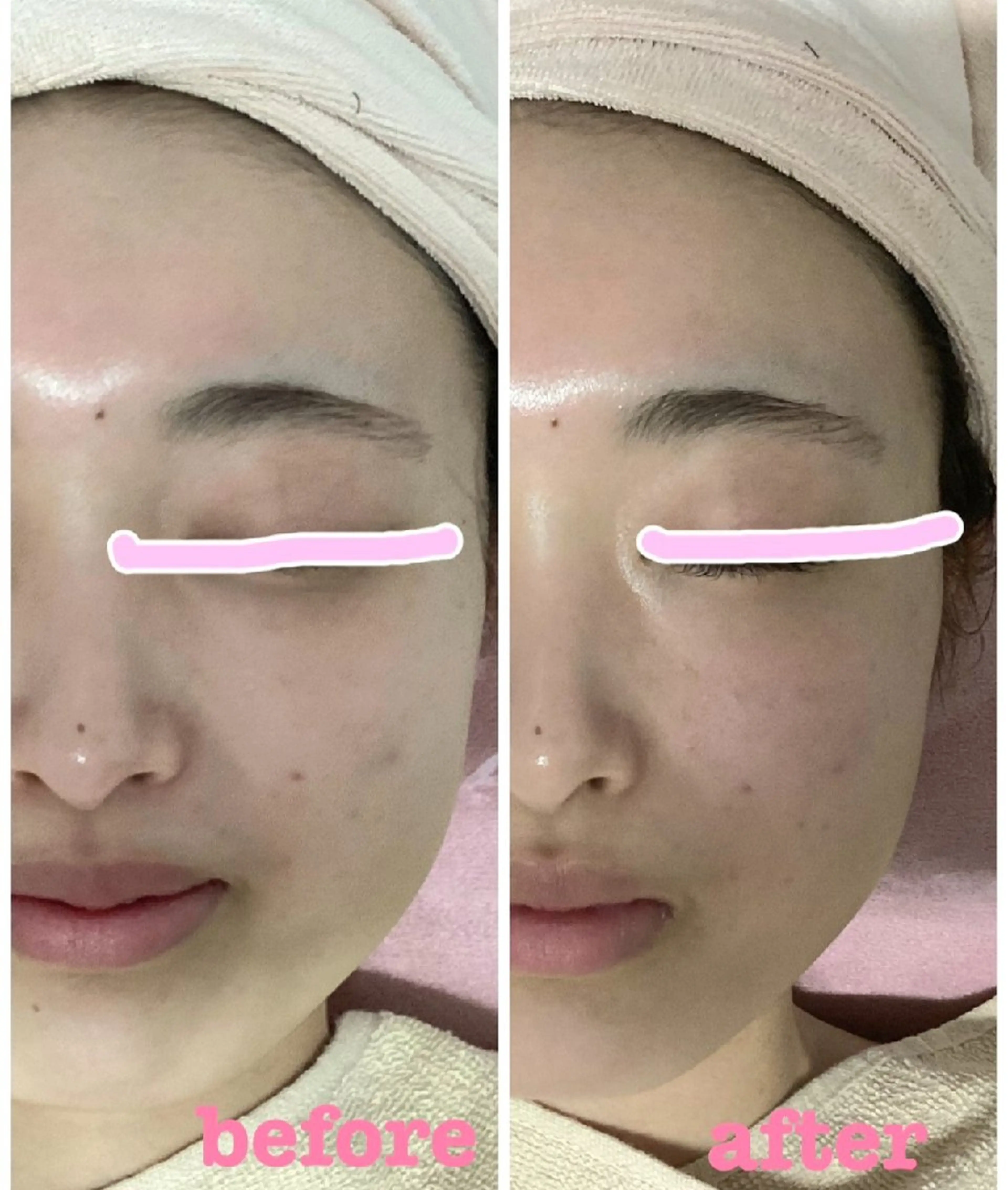 小顔エステ サクラ🌸ベルのエステ・リラクイメージ