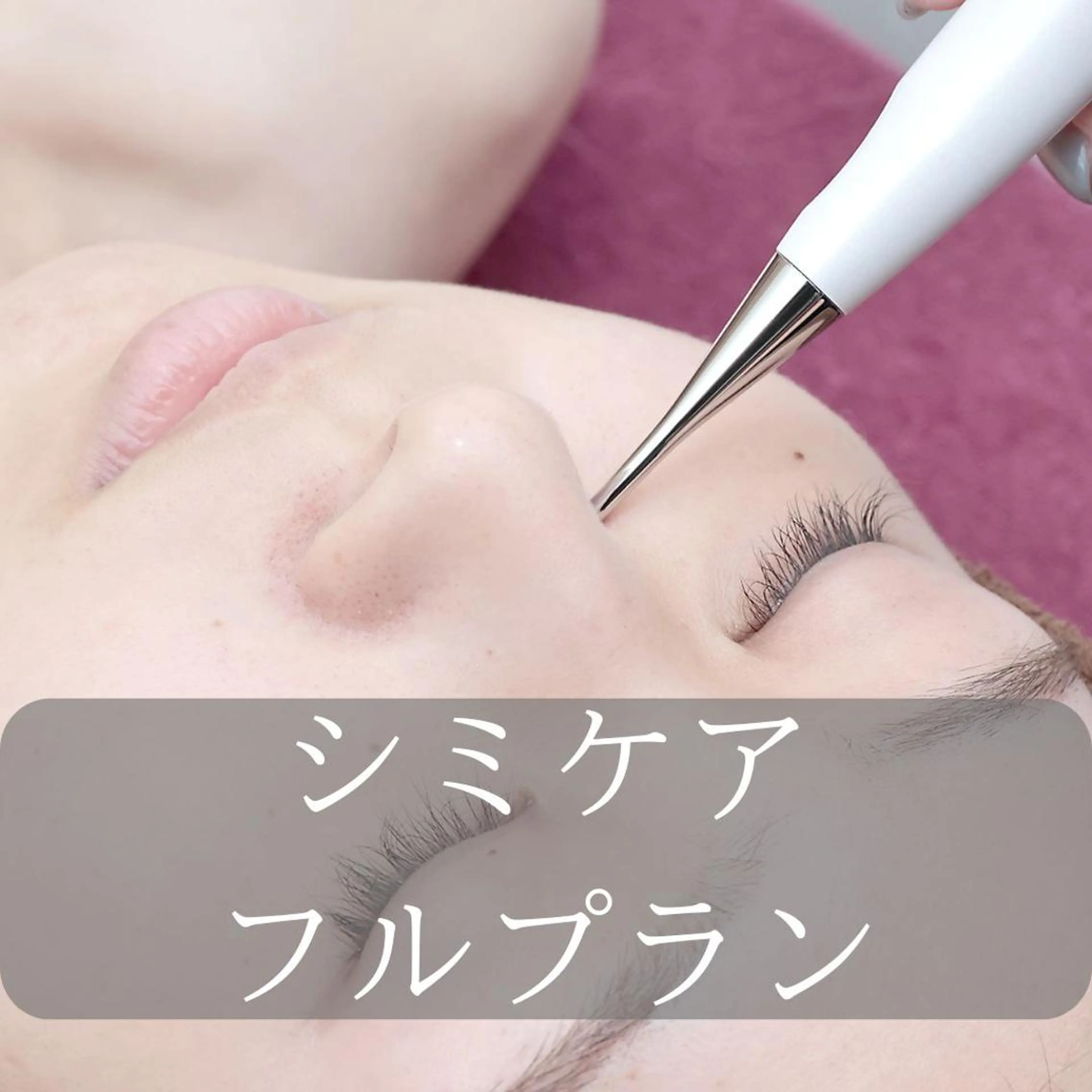 シミケアフルプラン18,700円→の写真