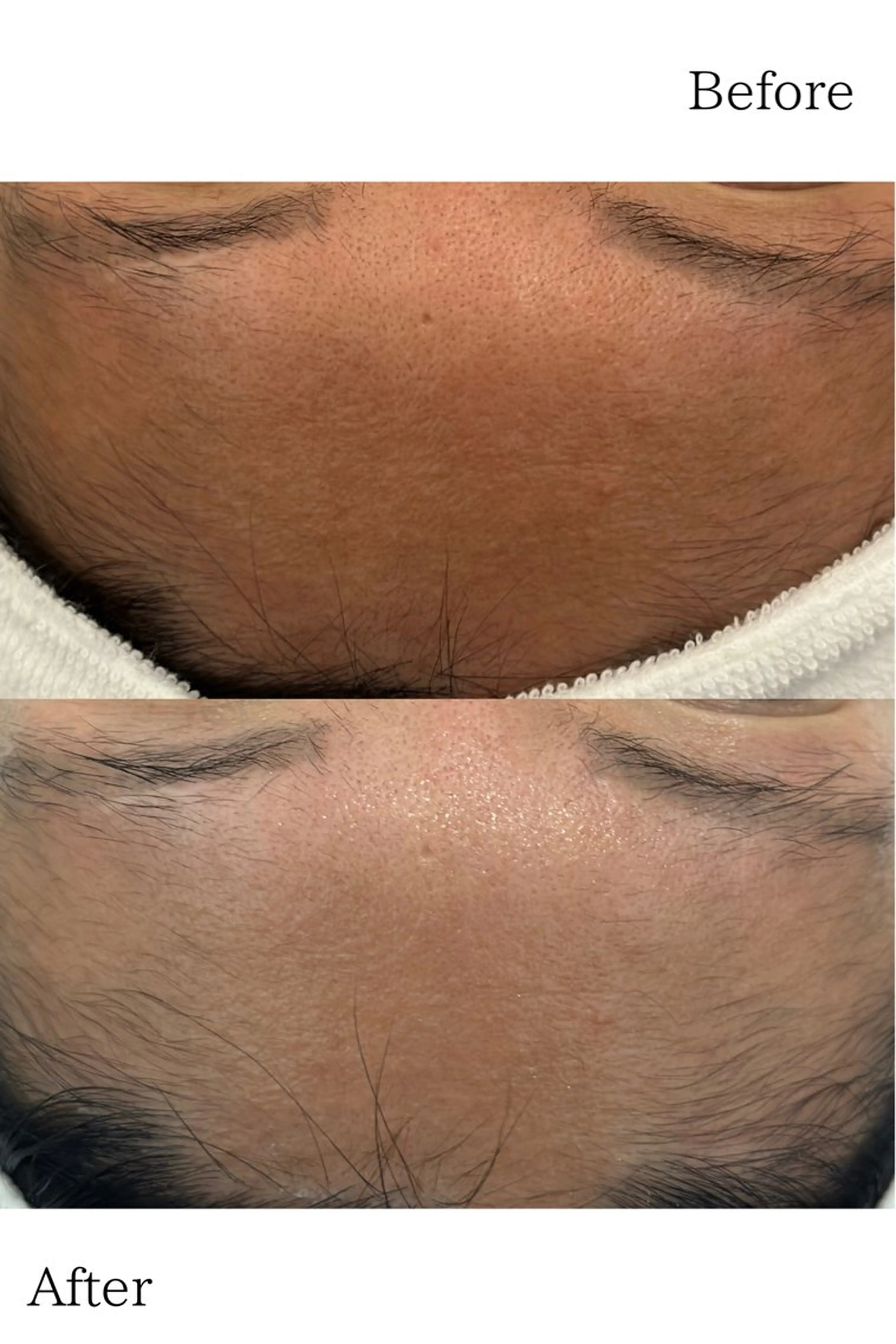 ＼口コミ書いてくださる方限定🎁／ｶｳﾝｾﾘﾝｸﾞとｴｽﾃ体験が無料🌿‬人気の為【毎月5名様限定】💖の写真