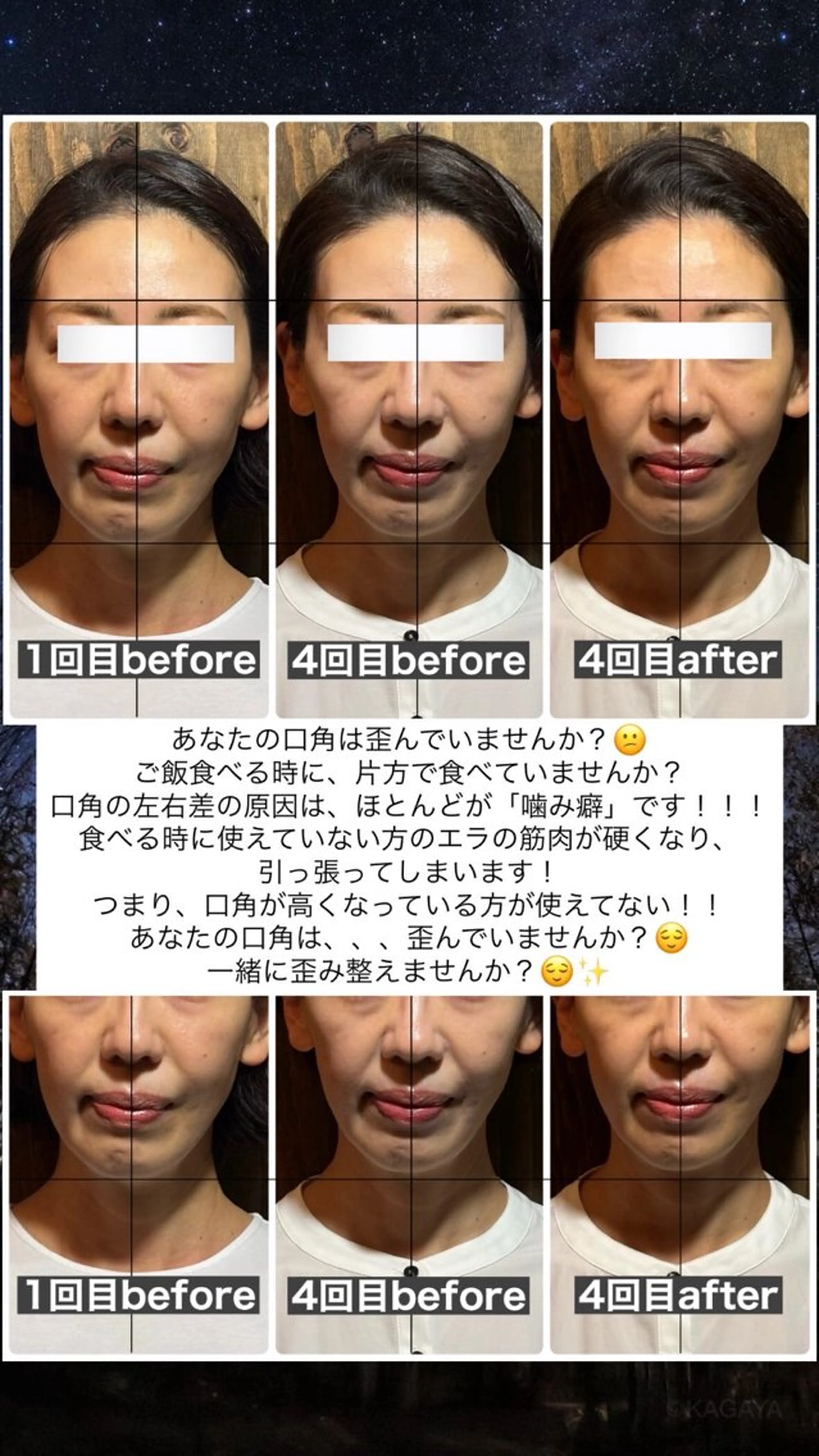 エステ リラク 💎後悔させない小顔 矯正💎イトヤマ🌱のエステ・リラクイメージ