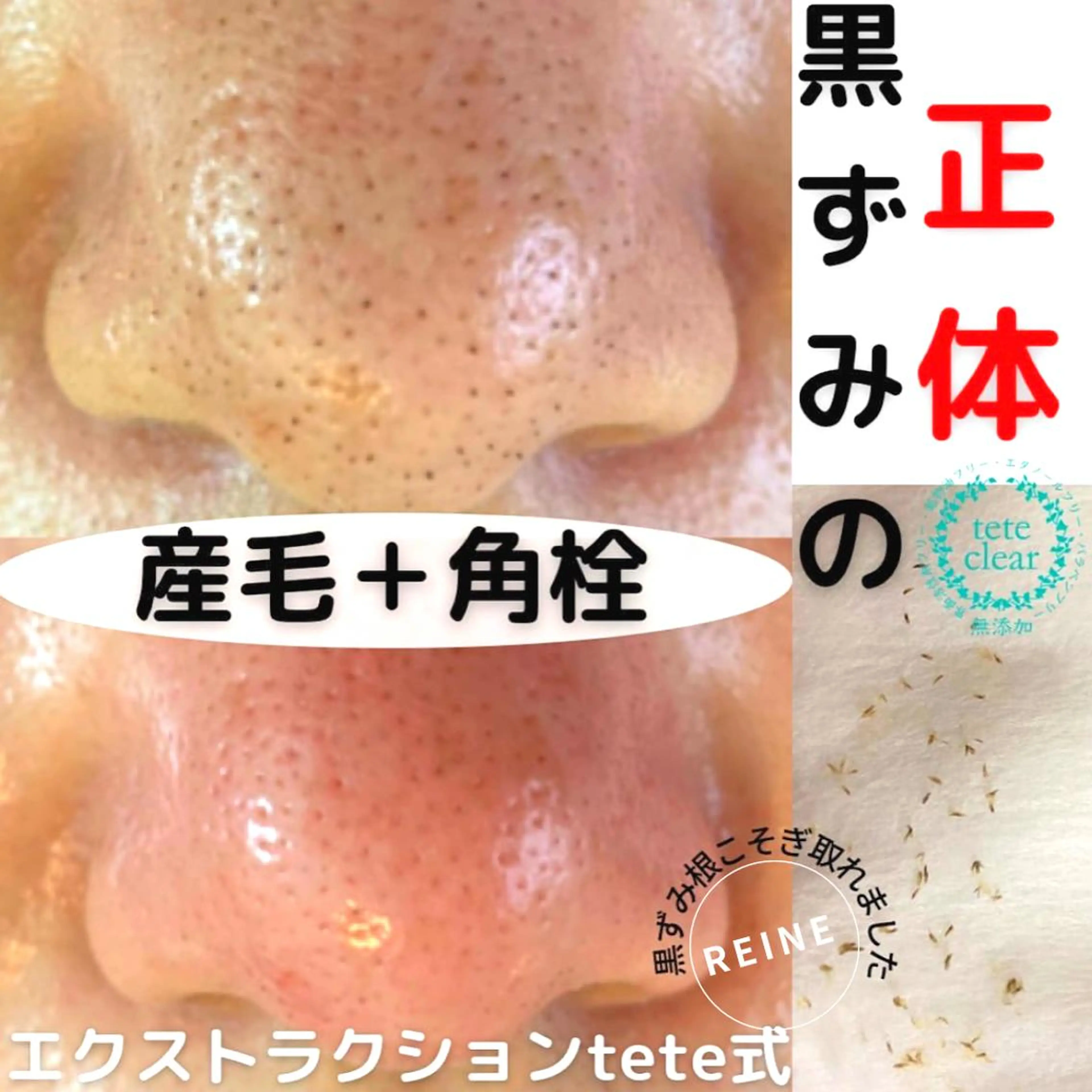 毛穴/シミ肝斑/脱毛 横山梨里のエステ・リラクイメージ