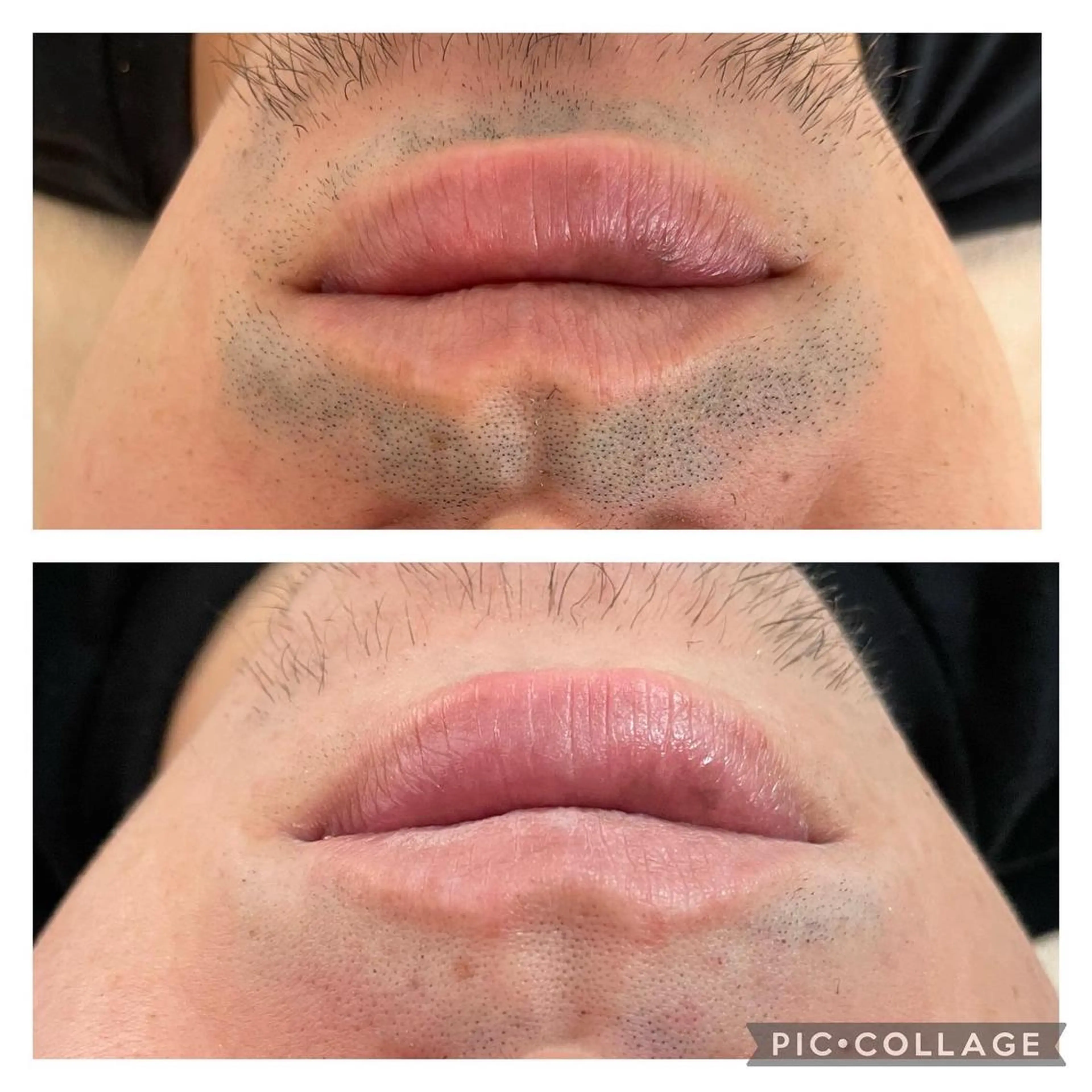 脱毛 ココネローズ 岡崎サロンのエステ・リラクイメージ