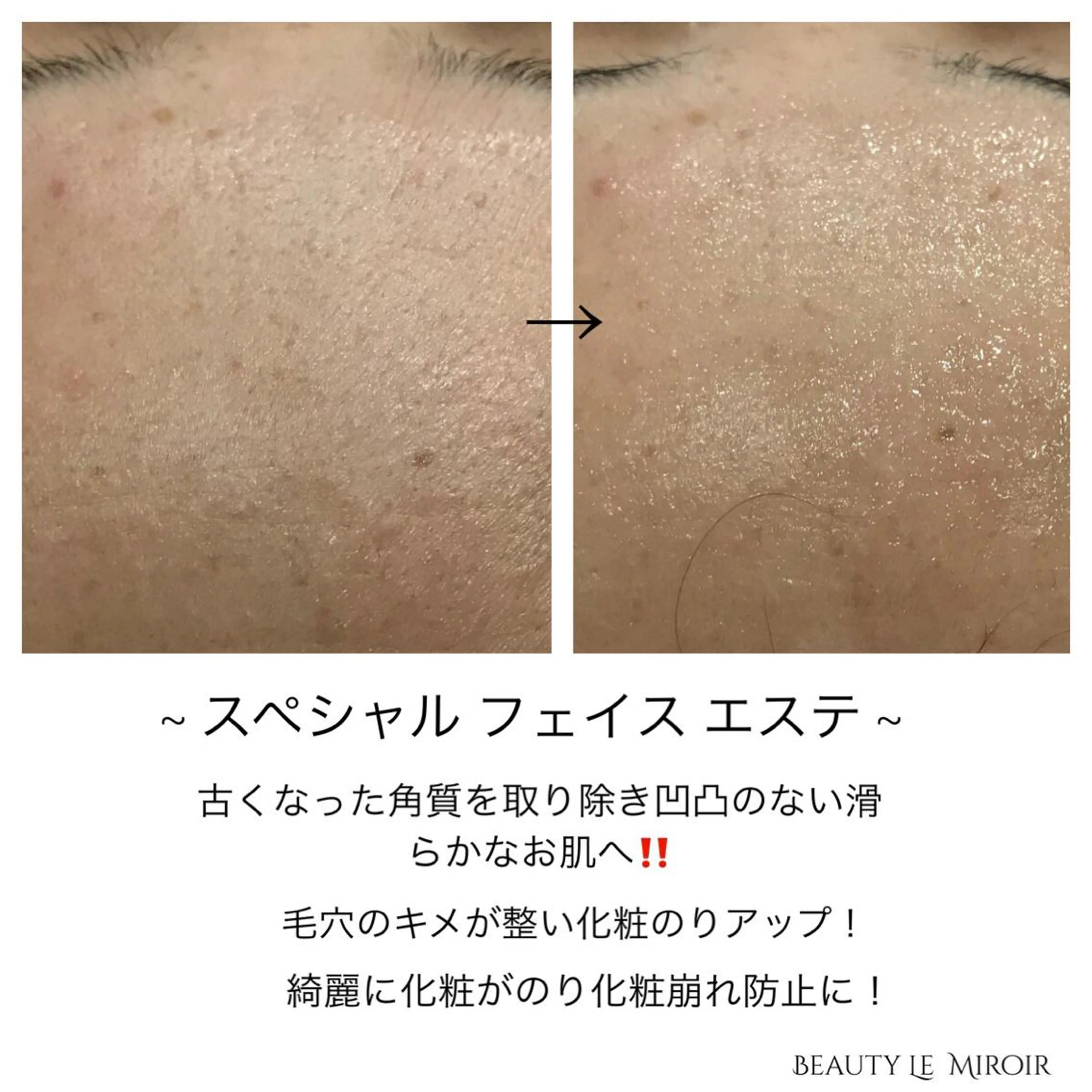 ビューティー ミロワールのエステ・リラクイメージ