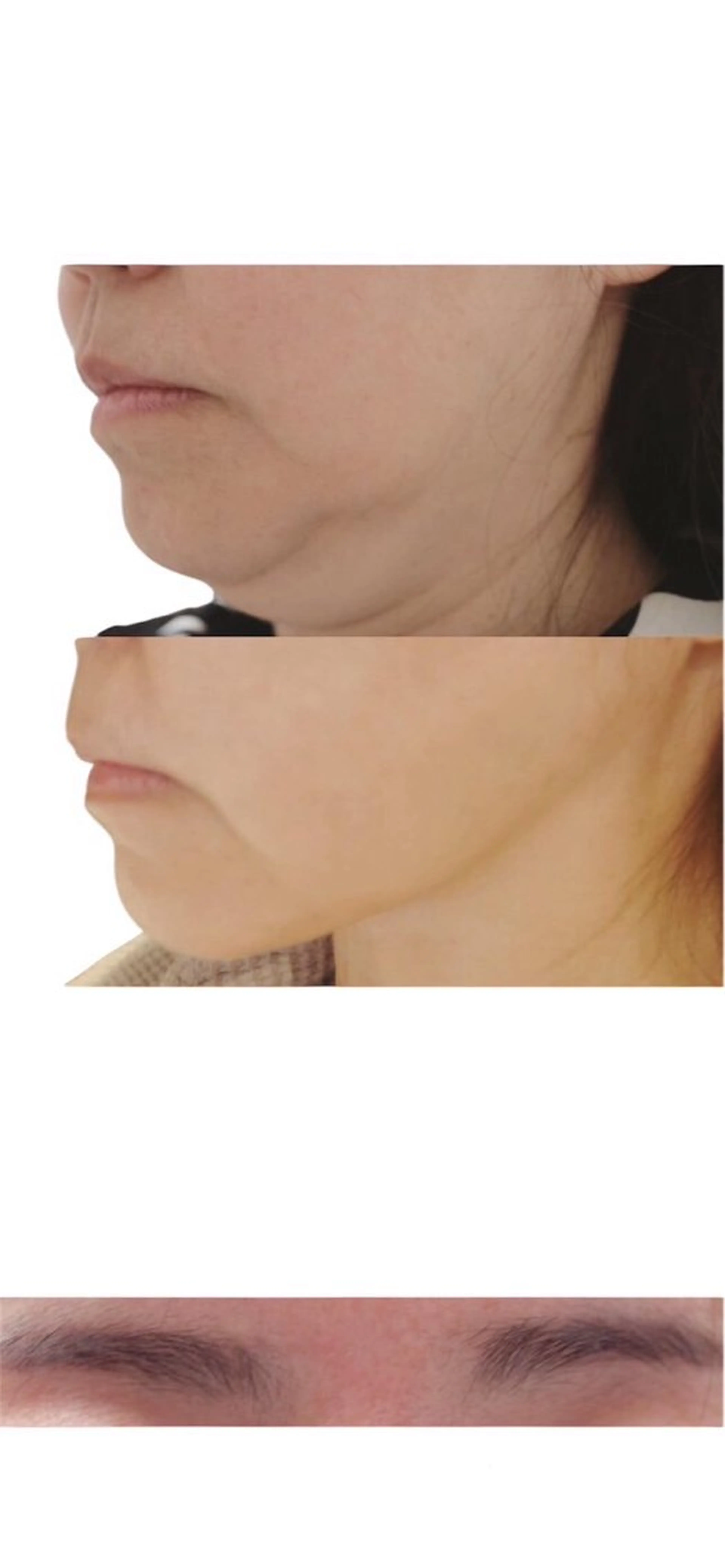 エステ 秒速小顔所属・秒速小顔 岩邊のその他イメージ