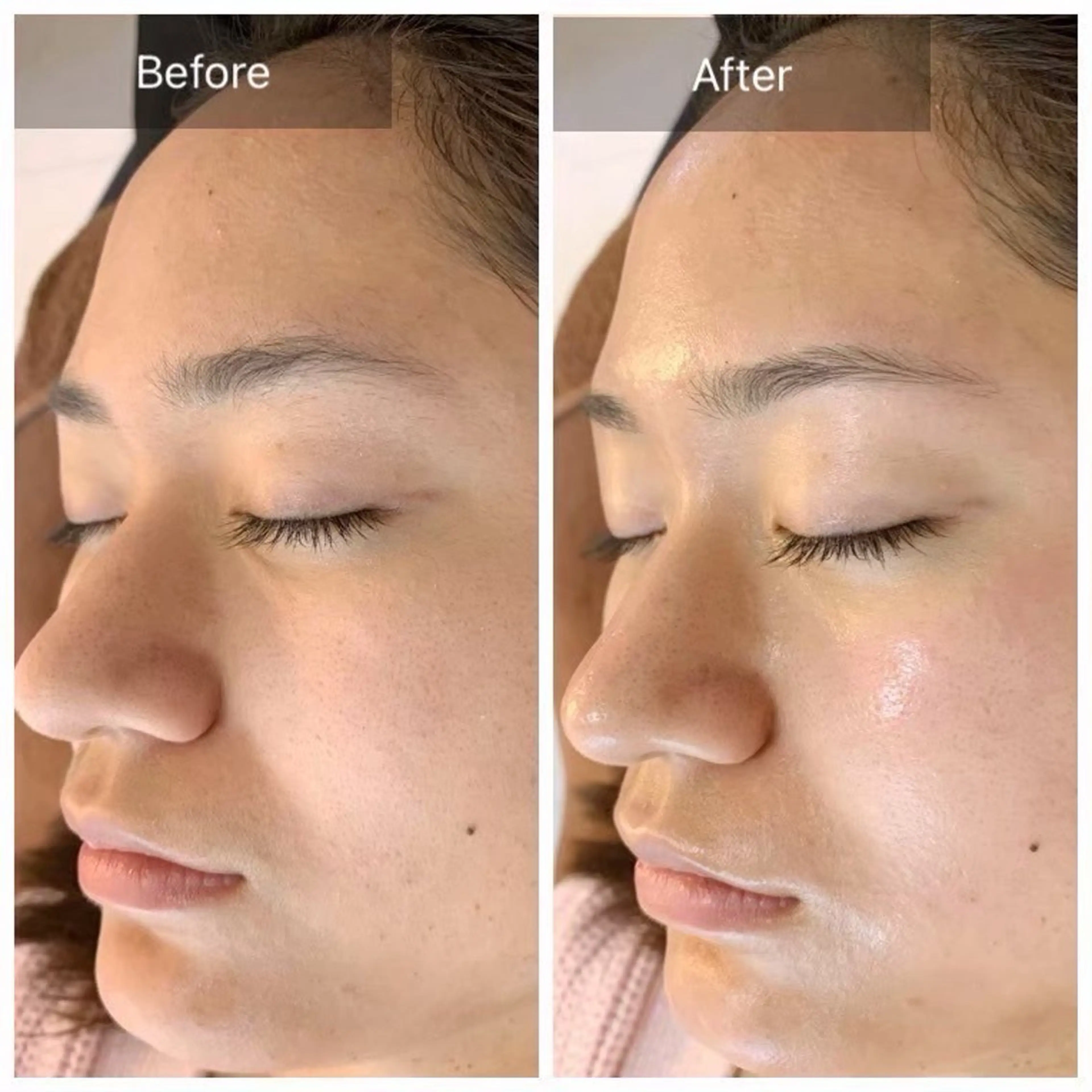 その他 EMINAL AOI✨のエステ・リラクイメージ