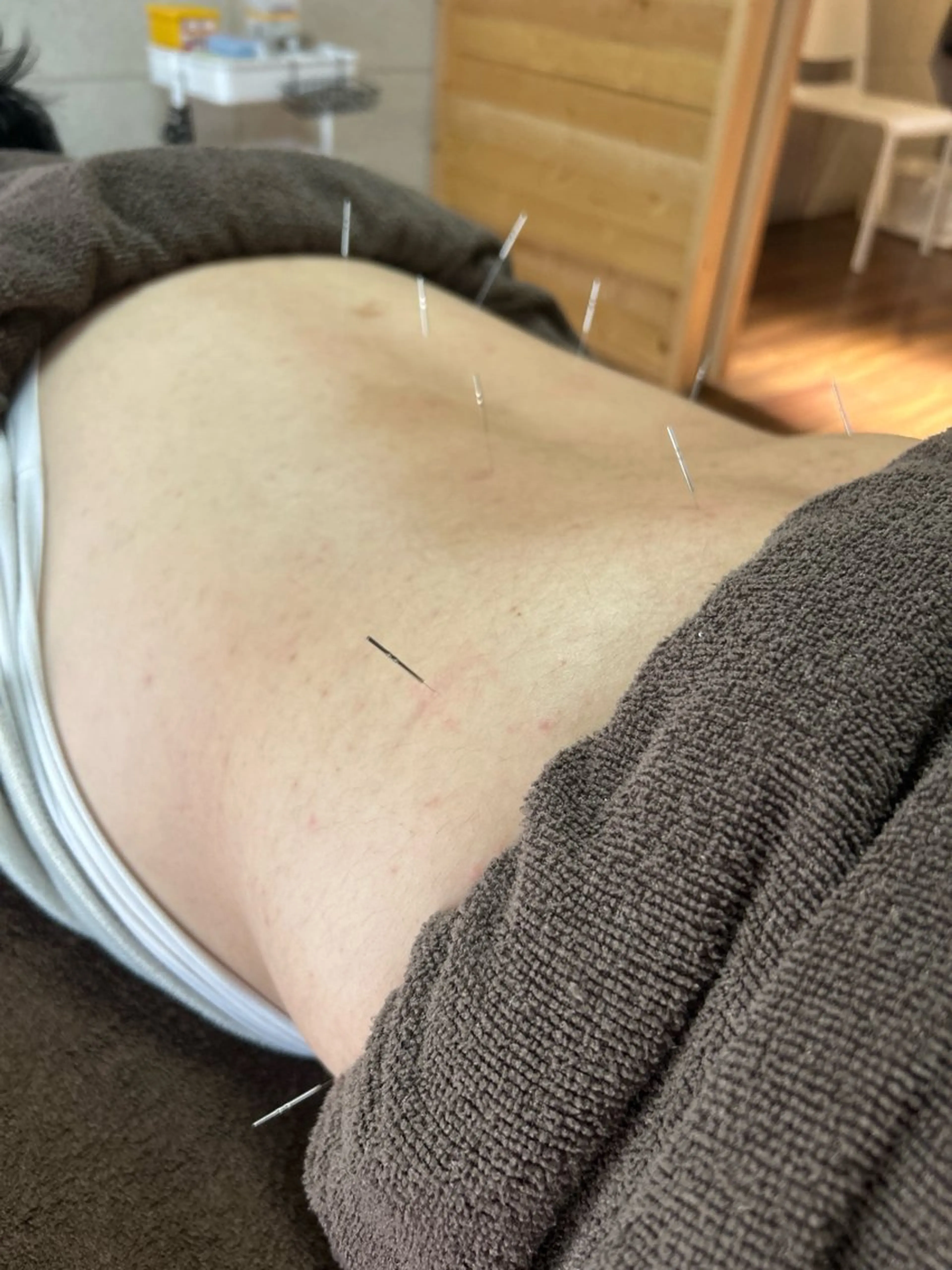 clear鍼灸院 清水【吉祥寺】のエステ・リラクイメージ