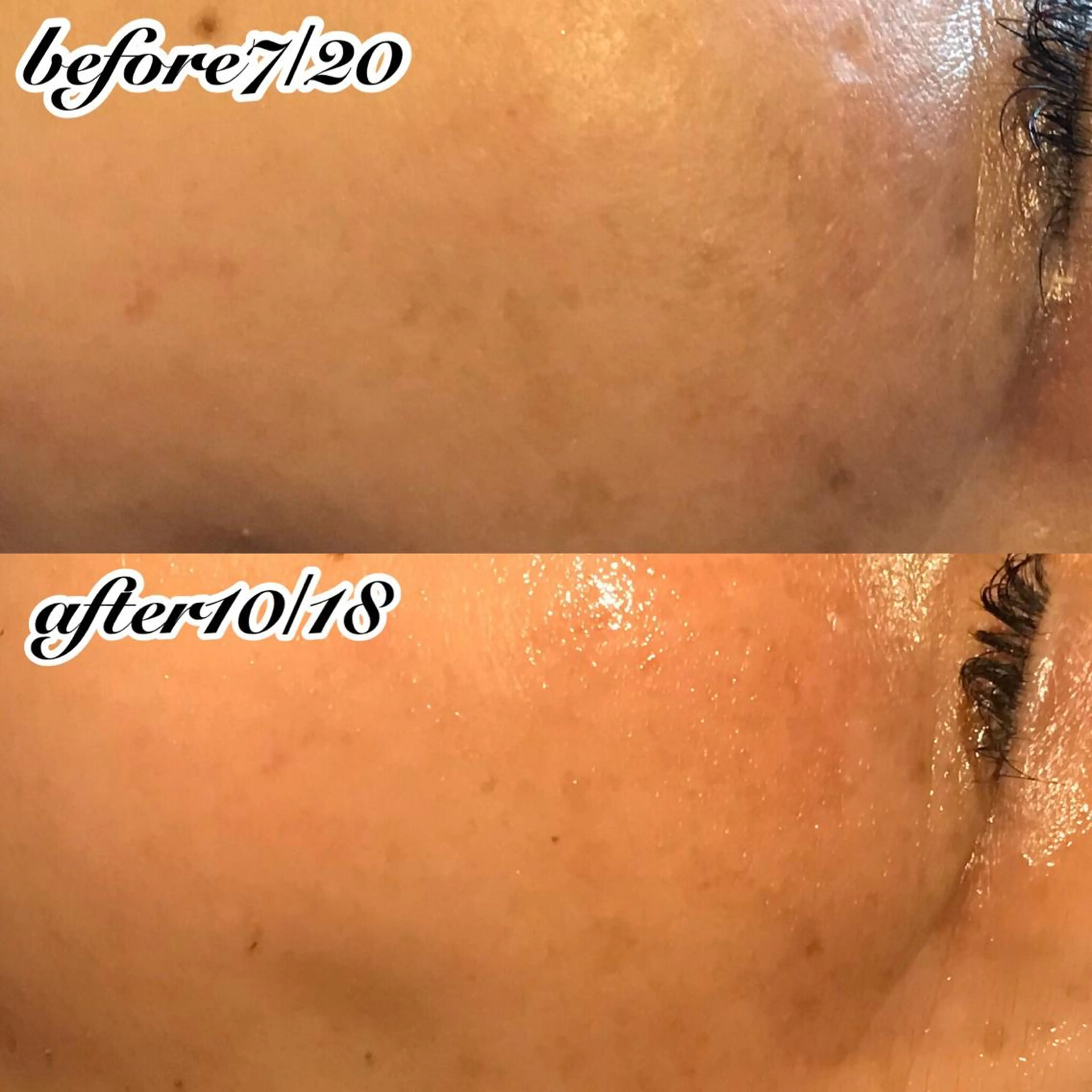 エステ 浜野 恵美のエステ・リラクイメージ