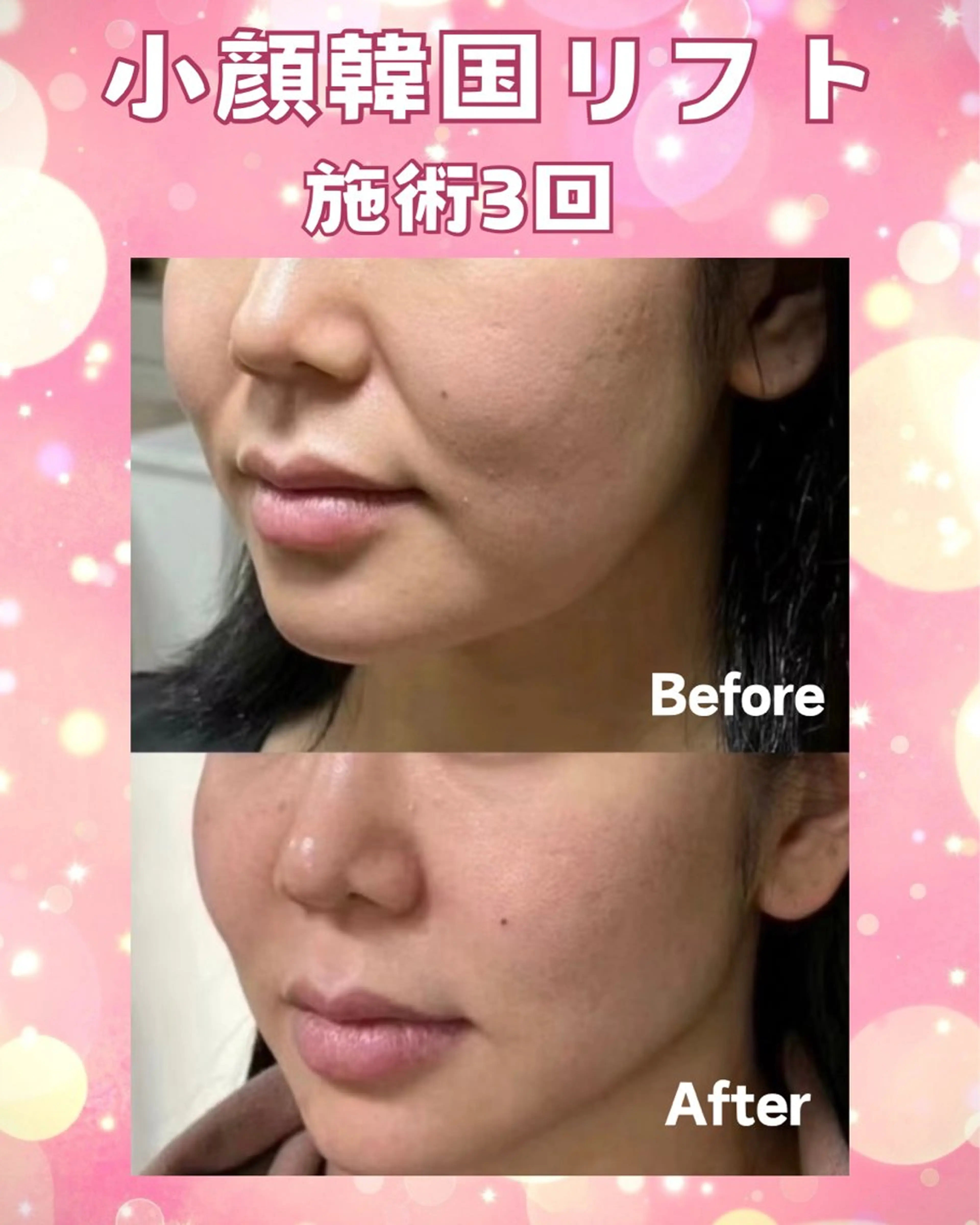 マツエク・マツパ エステ リラク 愛維美水光美肌専門店 メンズレディースokのエステ・リラクイメージ