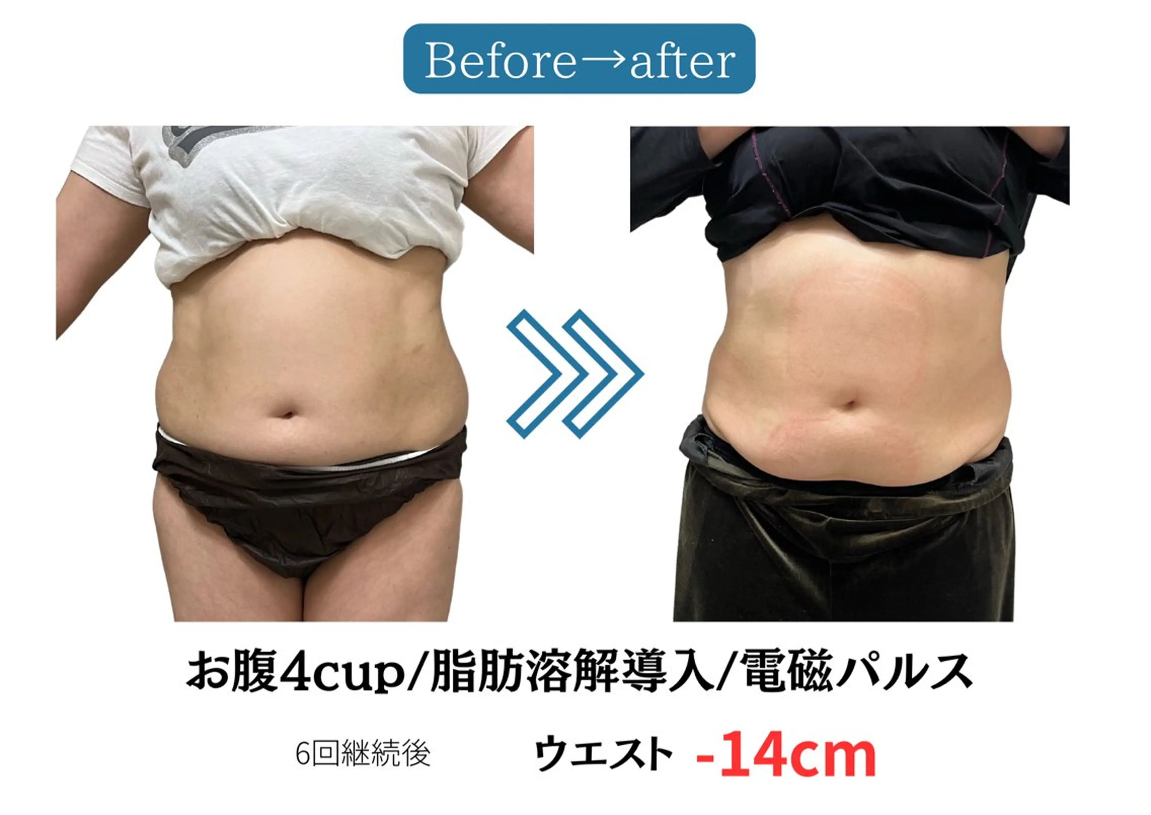 エステ 【脂肪冷却痩身サロン】una.福岡所属・UNA 福岡のエステ・リラクイメージ