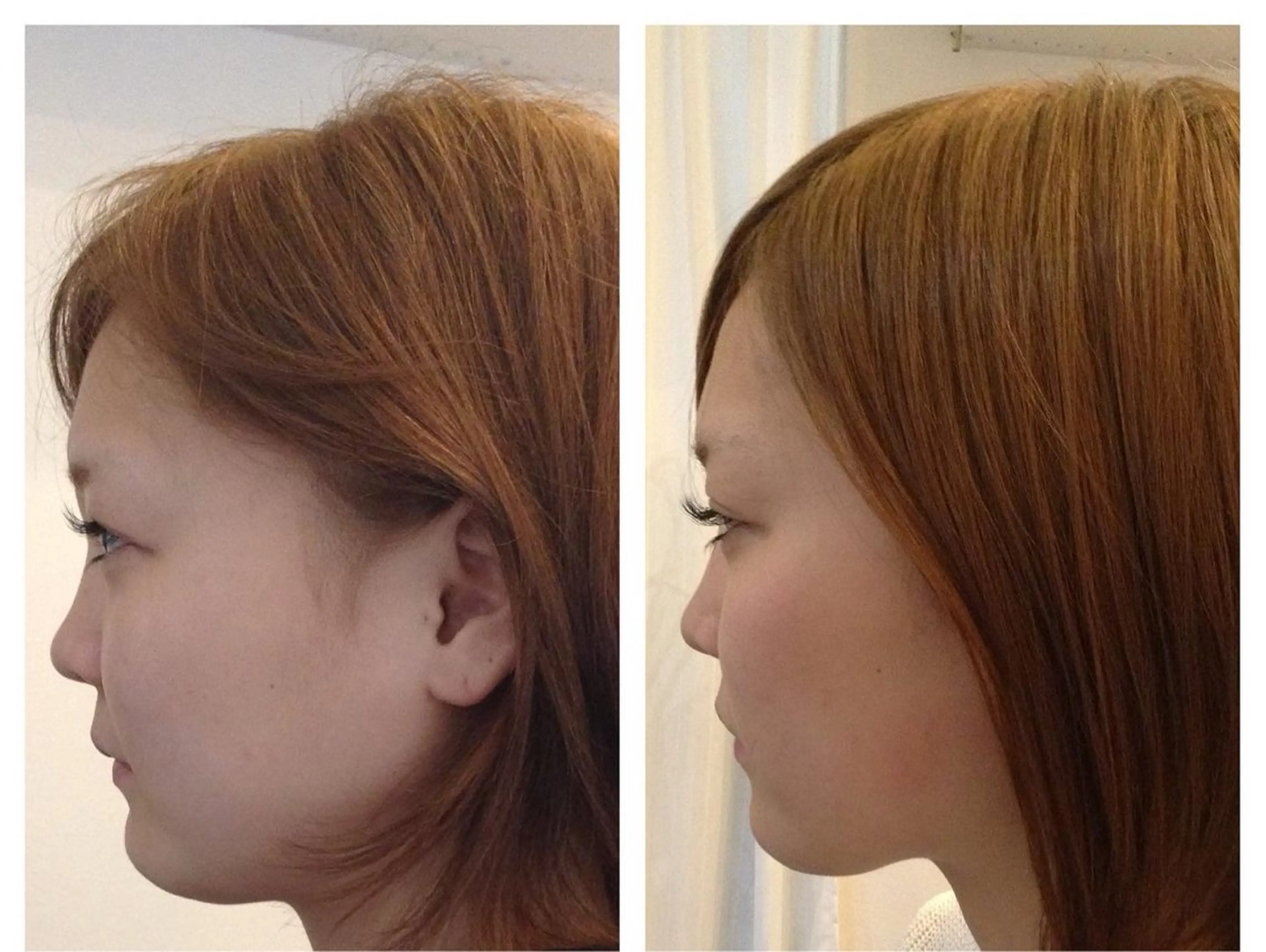 小顔・姿勢矯正専門 〜Re・birth〜のその他イメージ