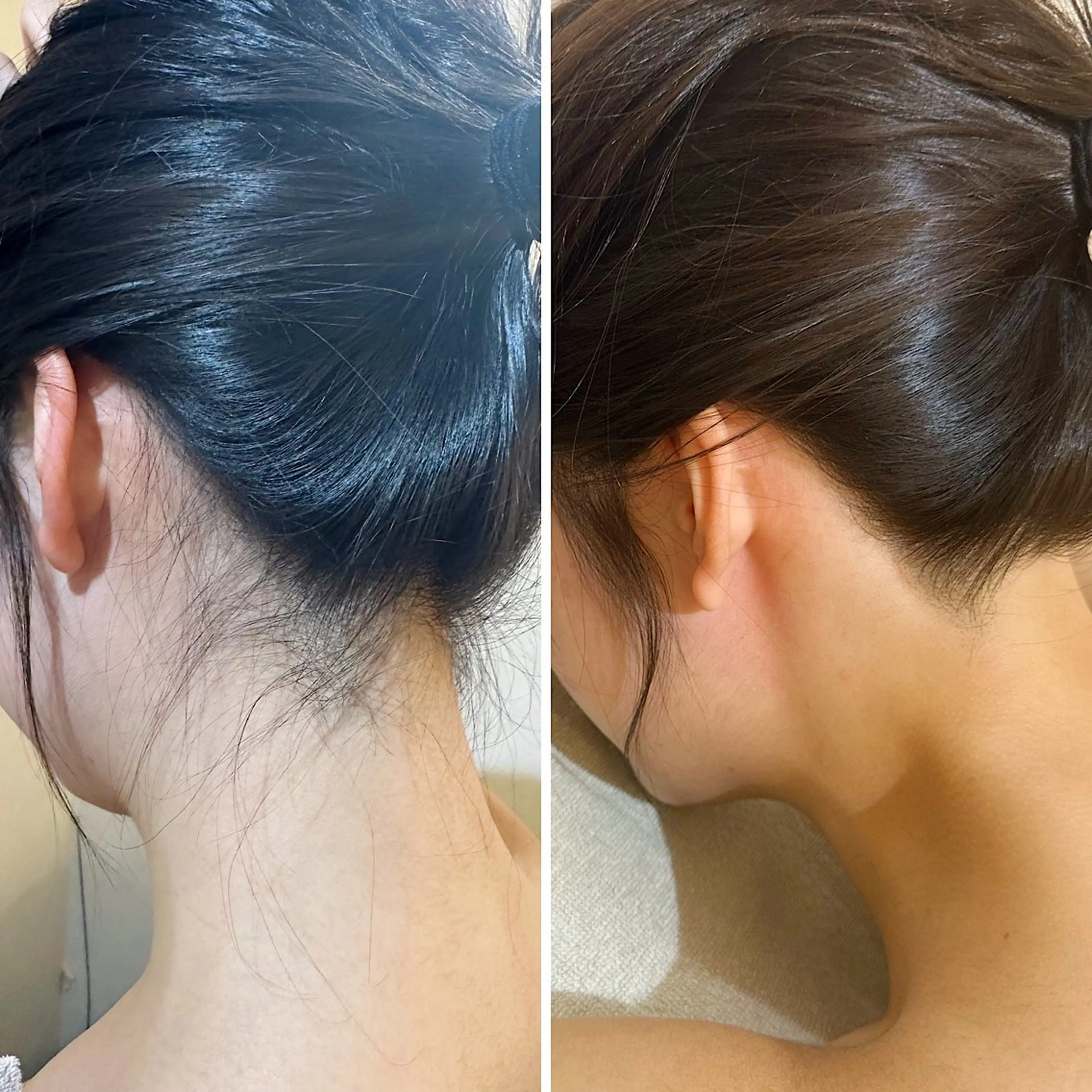 脱毛 うなじ脱毛/美肌脱毛 LABELのエステ・リラクイメージ