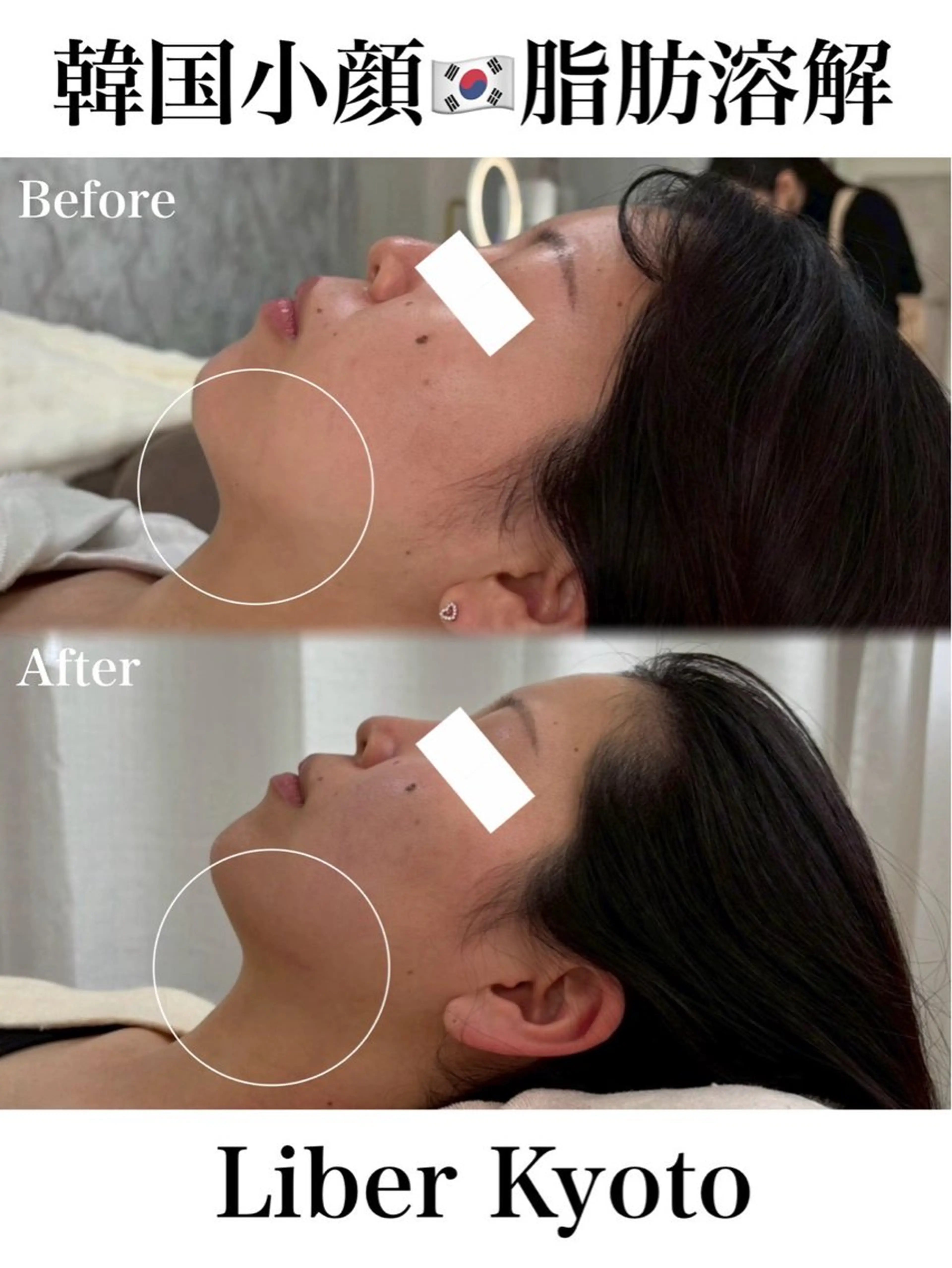 エステ Liber【リベル】 AYAKAのエステ・リラクイメージ