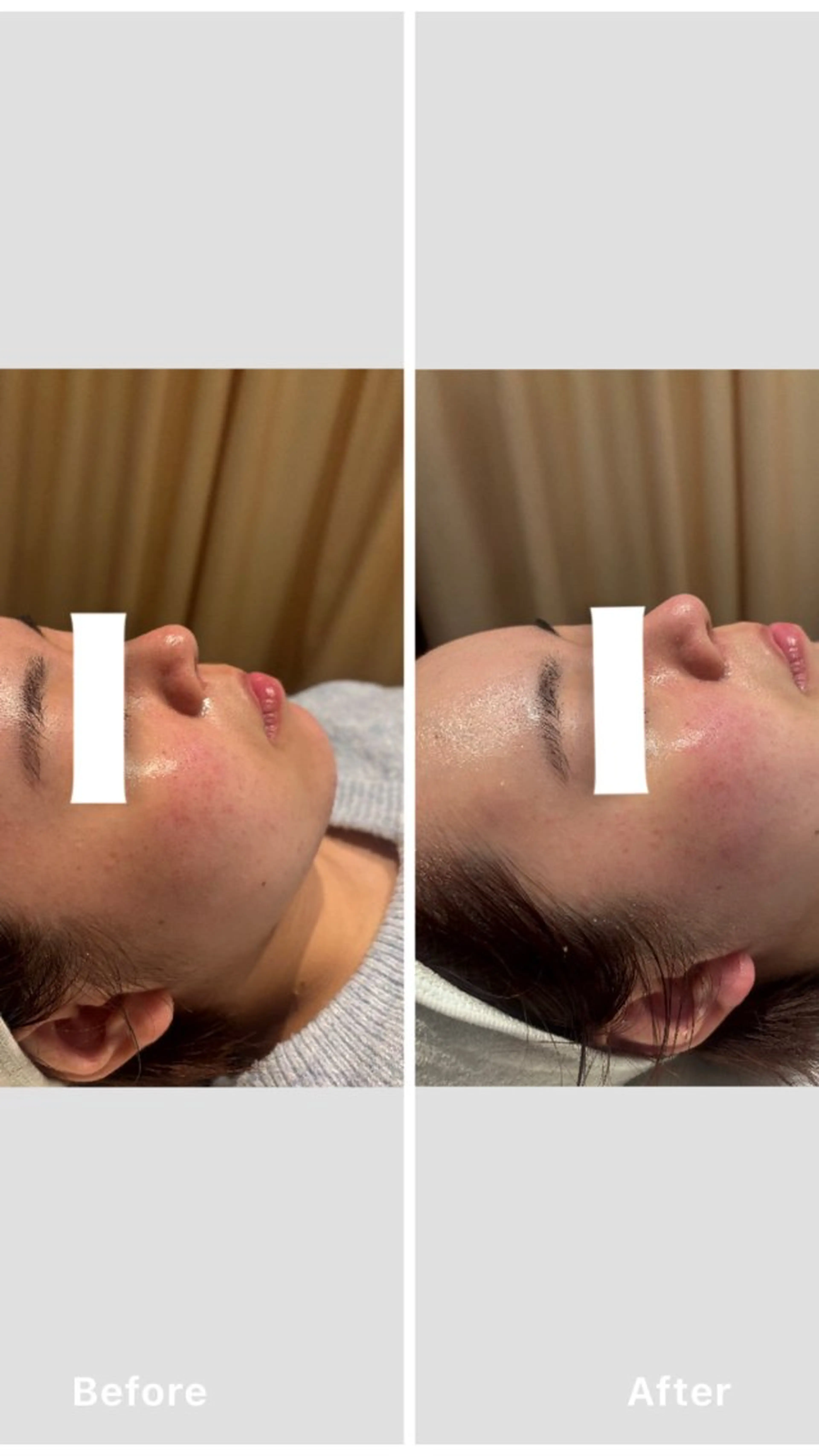 ベッドフェイシャルエステ タラソパックの写真