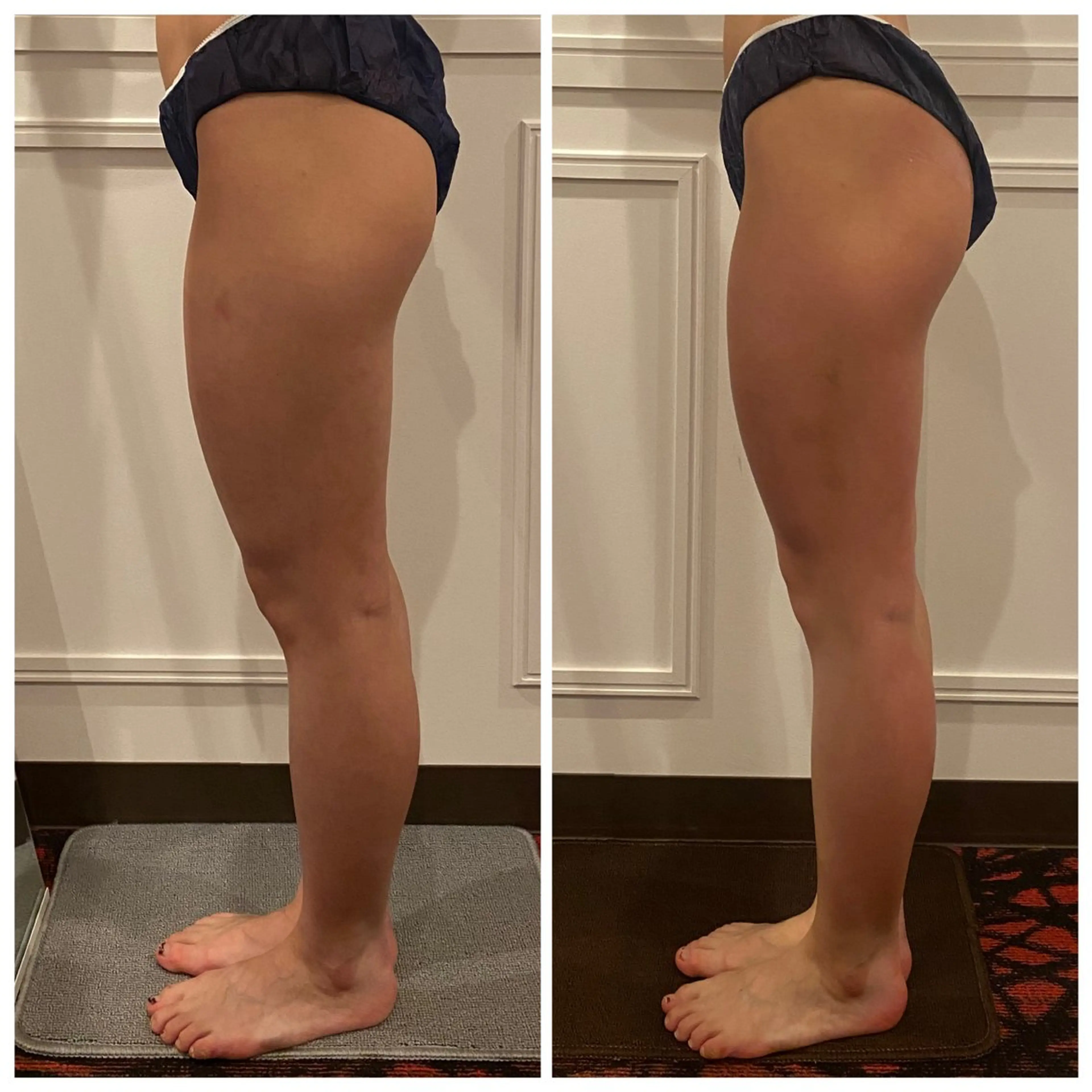 小顔EX心斎橋 REVIハーブのエステ・リラクイメージ