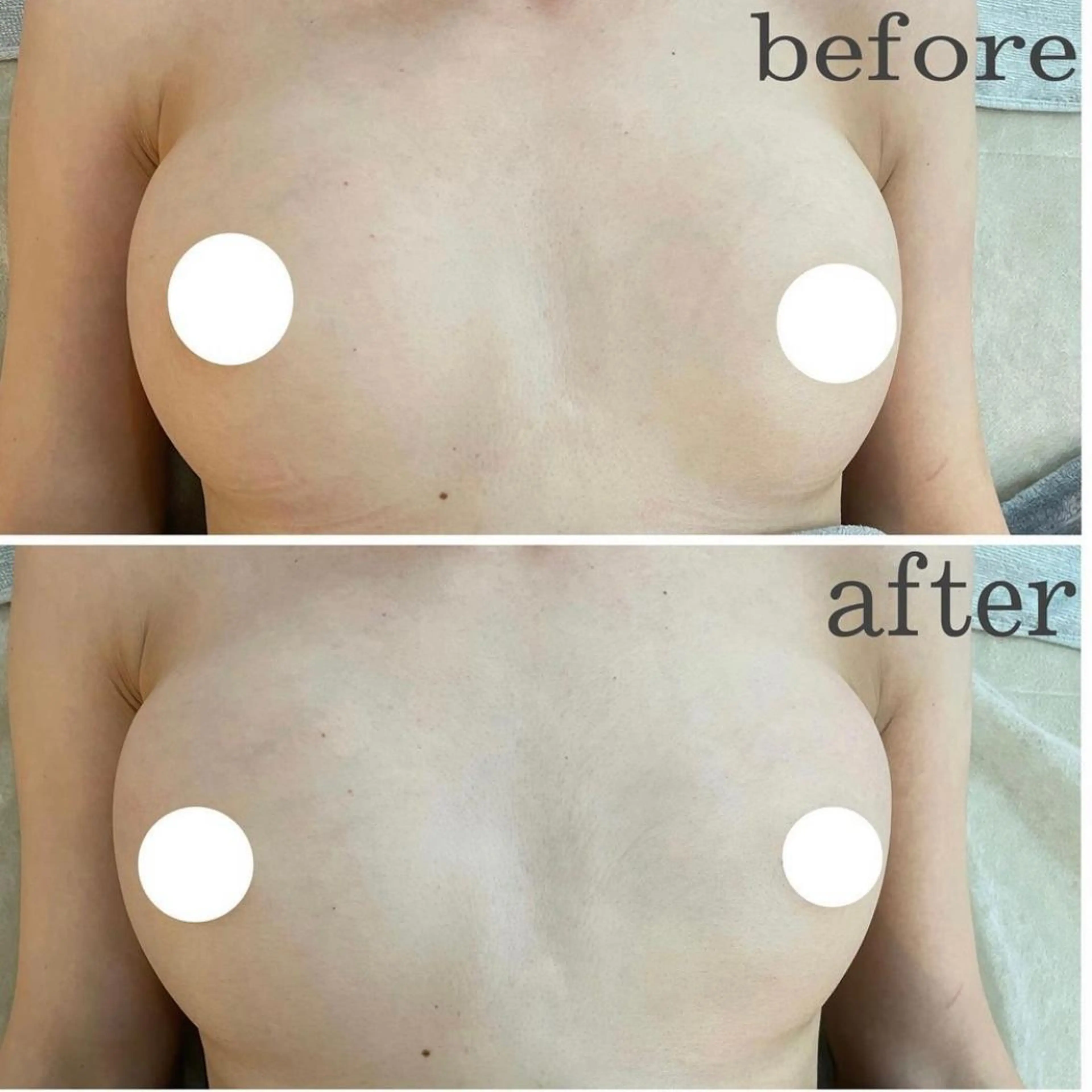 うなじ脱毛/美肌脱毛 LABELのエステ・リラクイメージ