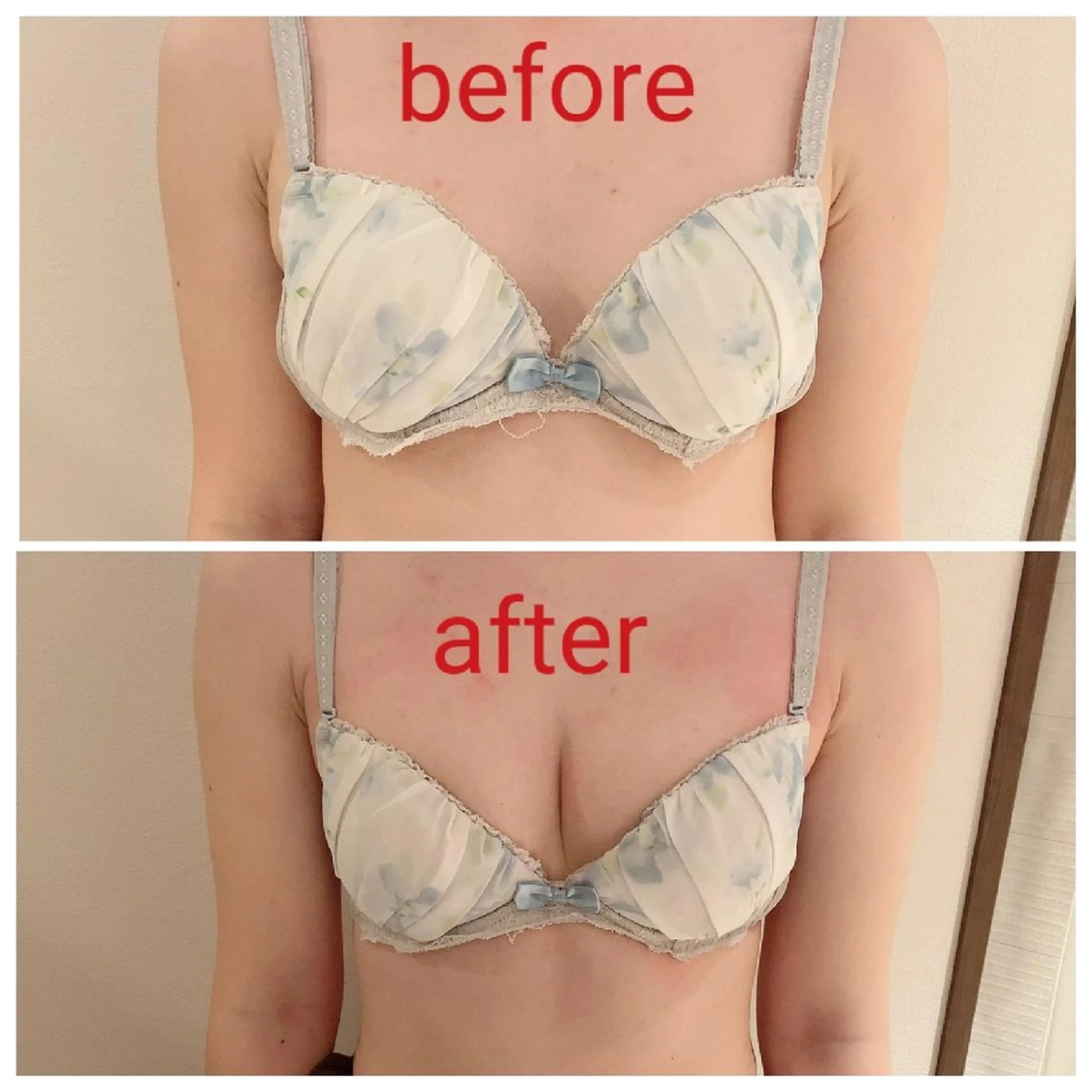 【ミニモ限定価格】大きさ・左右差・離れ乳・ハリ・下垂に◎バストアップ❤️オールハンド育乳マッサージビフォーアフターモデルの写真